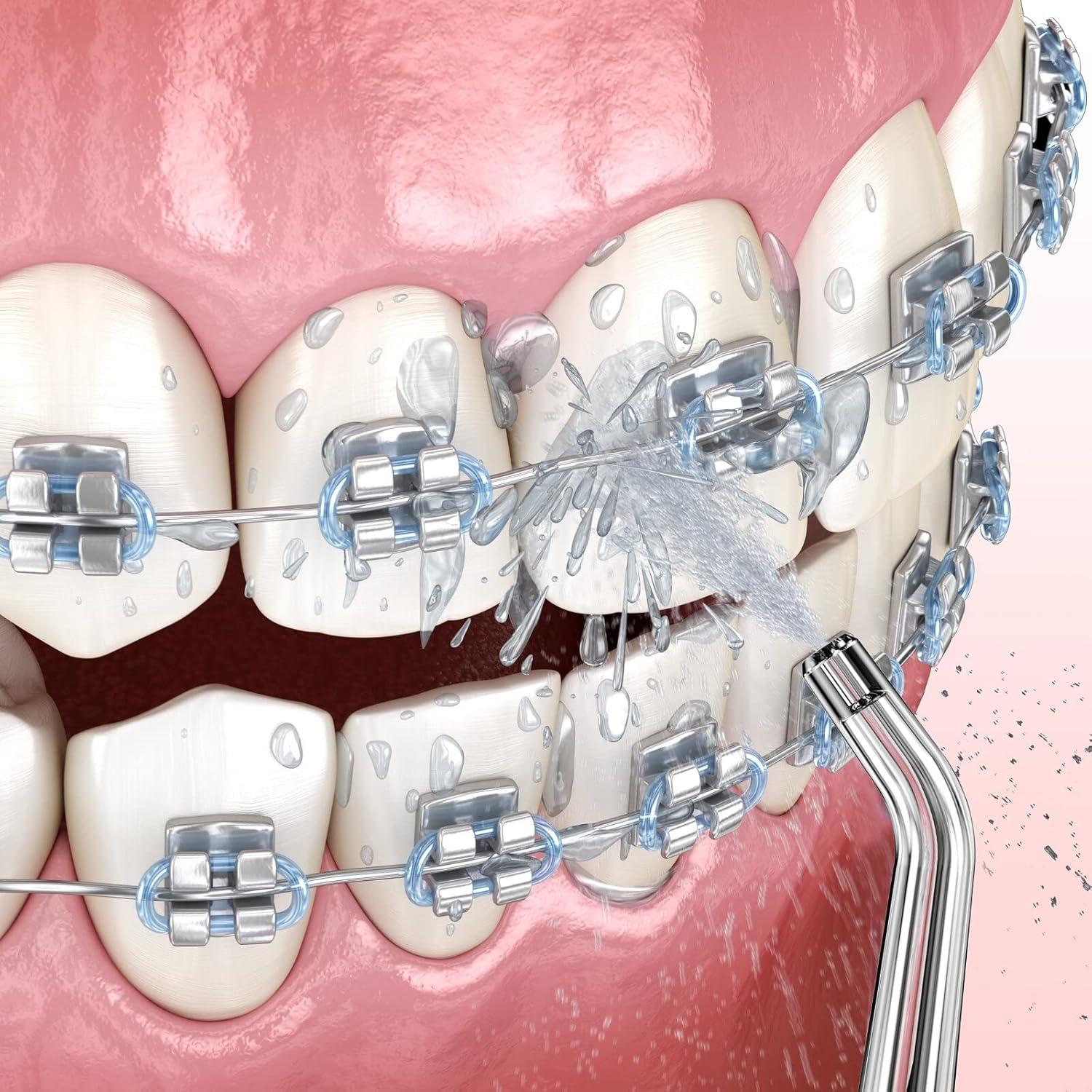 Setonia Replacement Tips for Water Flosser Classic Jet Tips 8 Pack