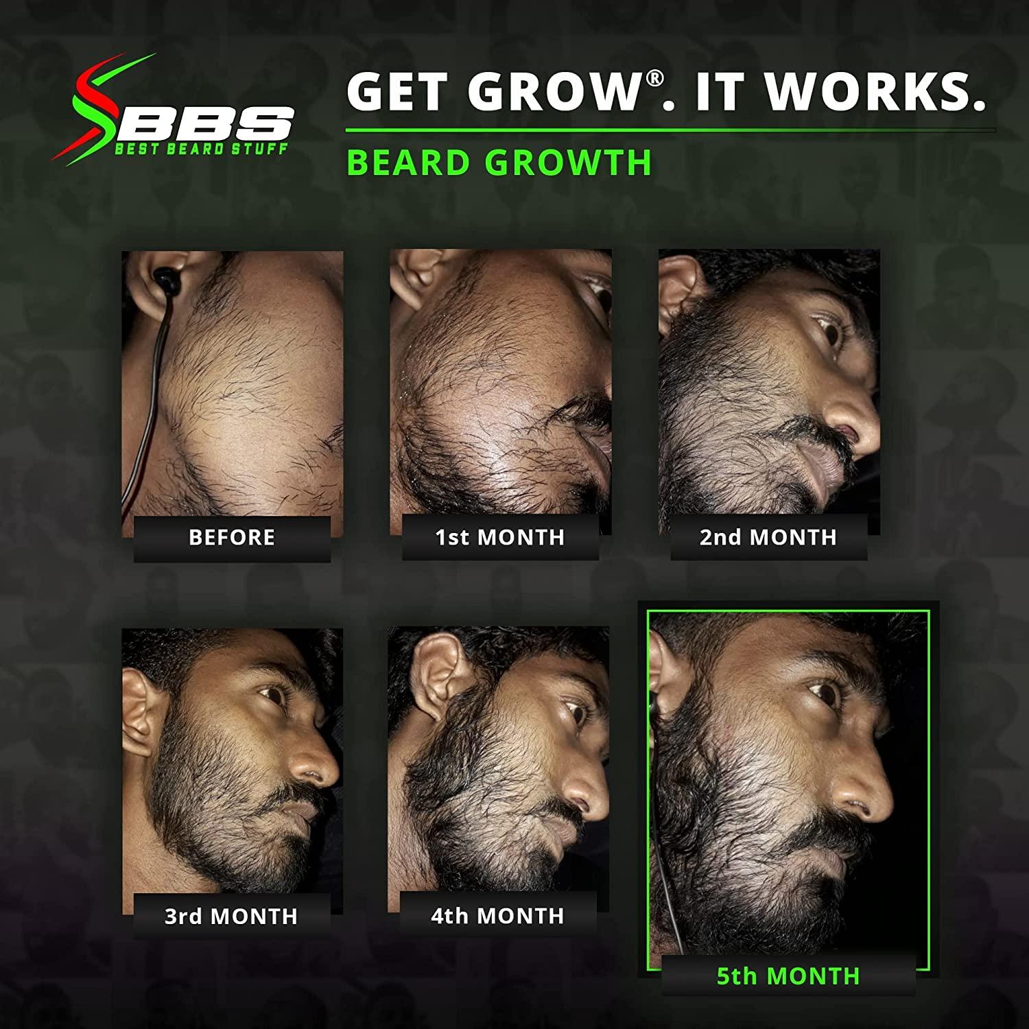 GROW Maximum XXL Hair & Beard Growth Oil for Men Fill Patches