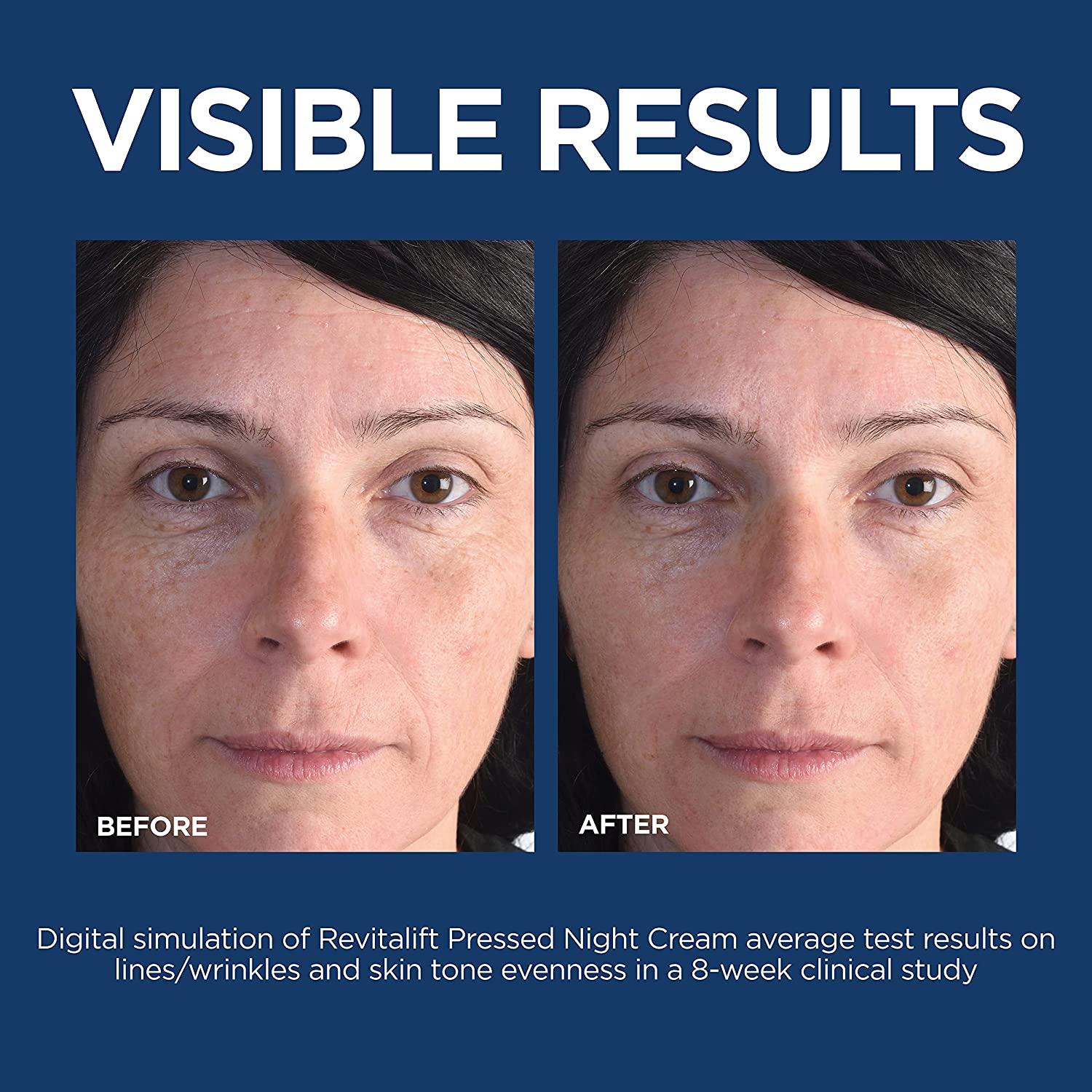 Revitalift Night Cream with Retinol & Niacinamide Hydrate & Reduce