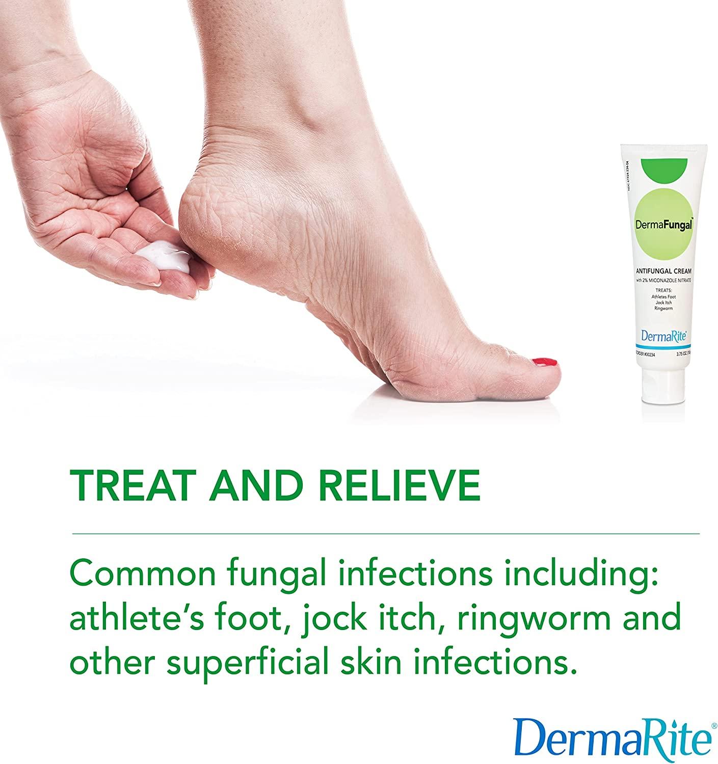 Athlete's foot cream for ringworm on cats shop