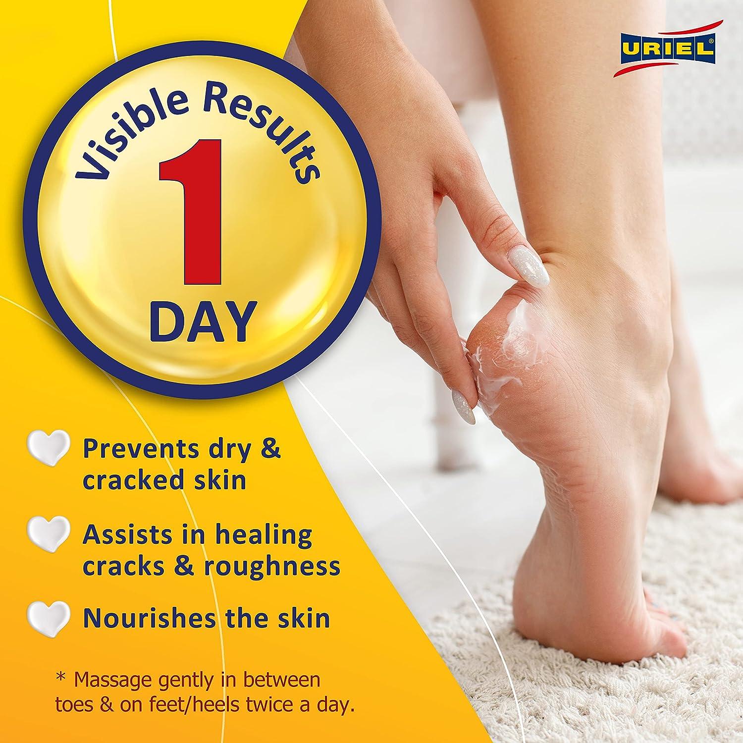 Home Remedies to Get Rid of Dry Cracked Heels