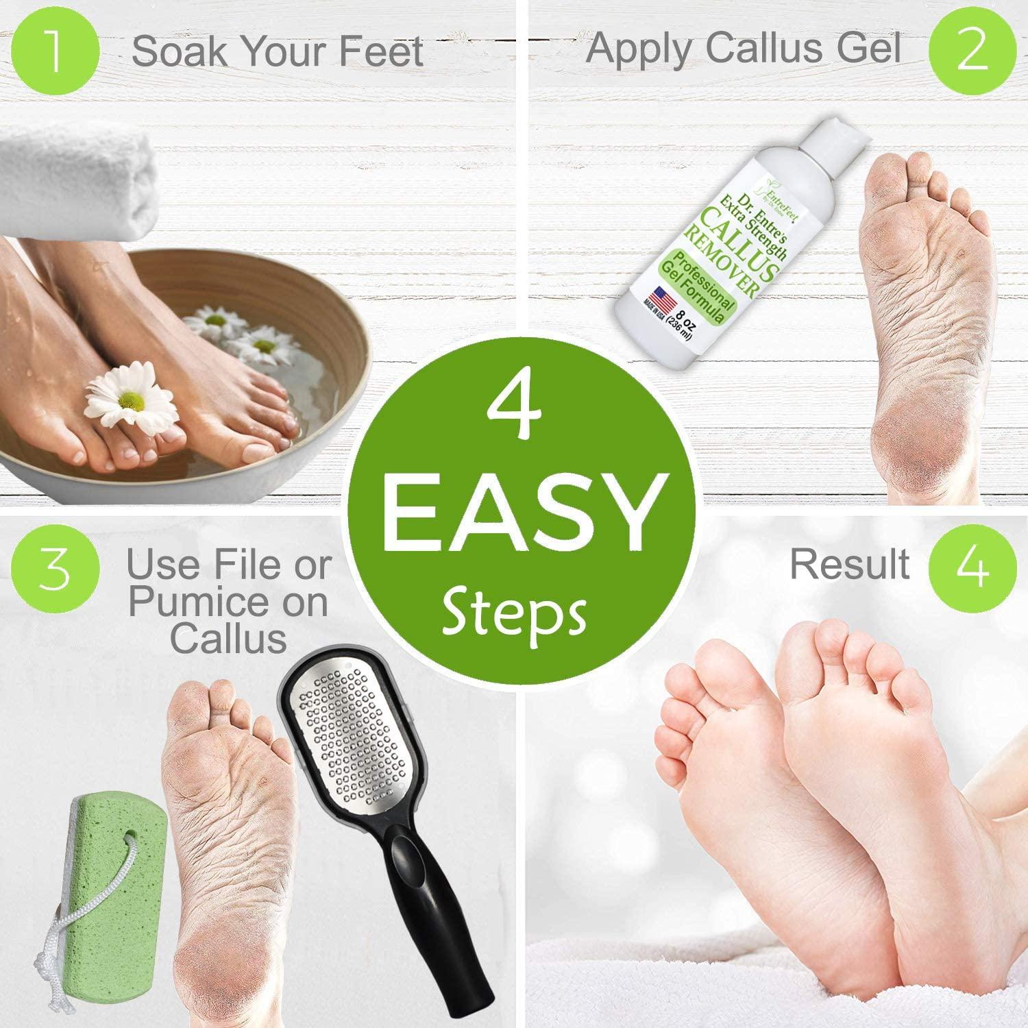 Dr. Entre's Callus Remover Kit for Feet: 8oz Callus Remover Gel