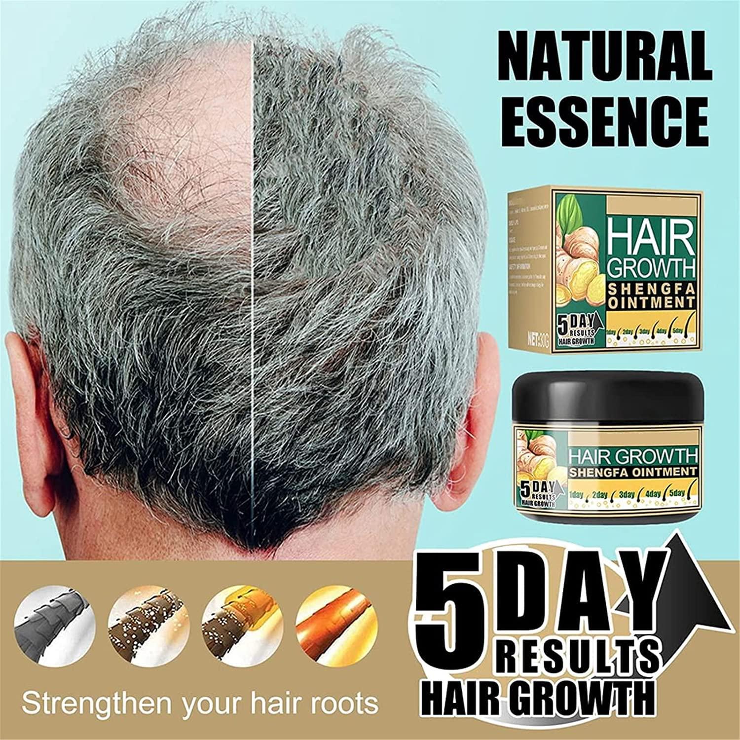 Natural Ginger Hair Growth Cream Hair Boost Ginger Ointment AntiHair