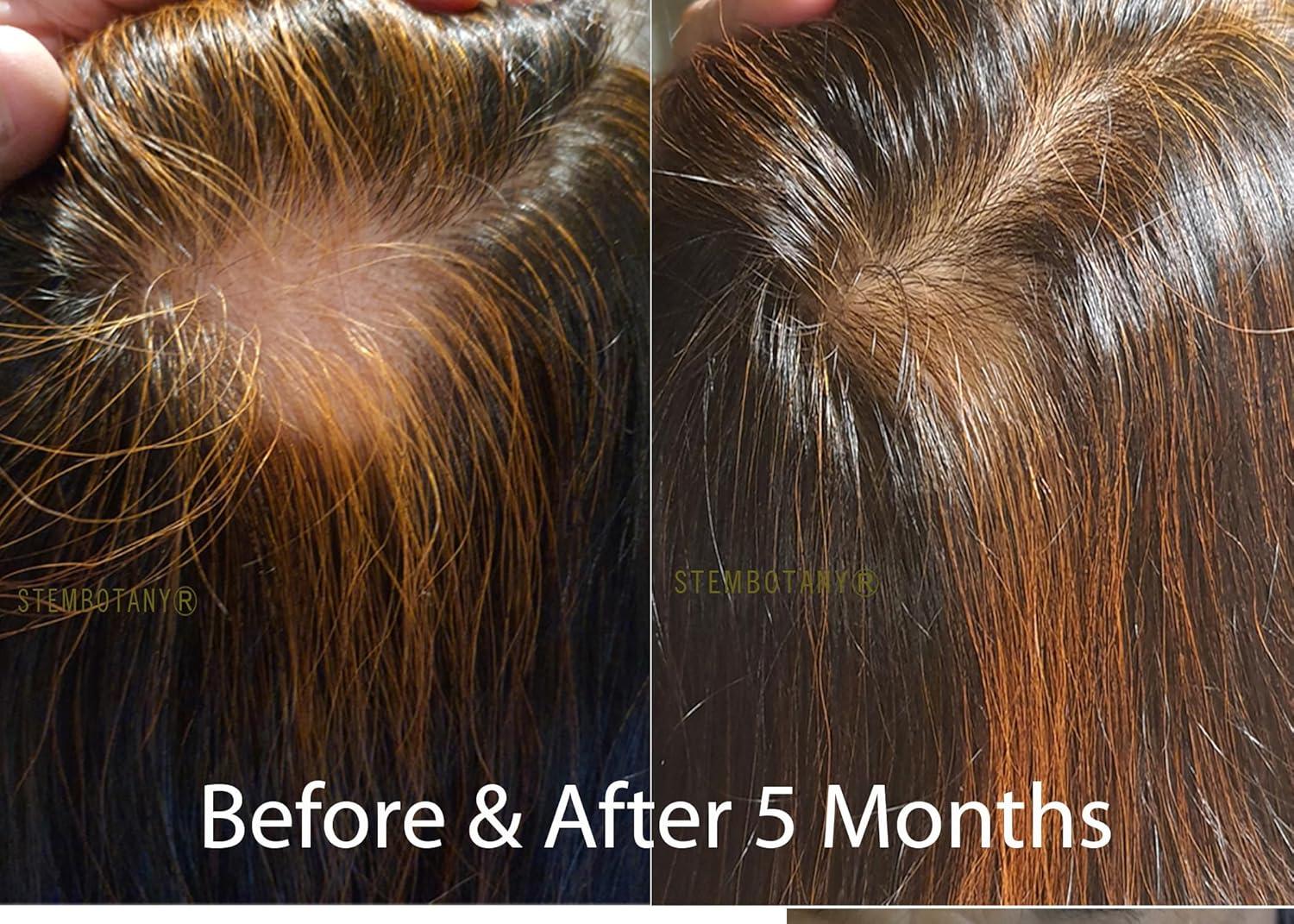 does ghk cu thicken hair Ghk-Cu Shampoo | Copper Peptide Hair Growth | Best Peptide for Hair Growth main image 0