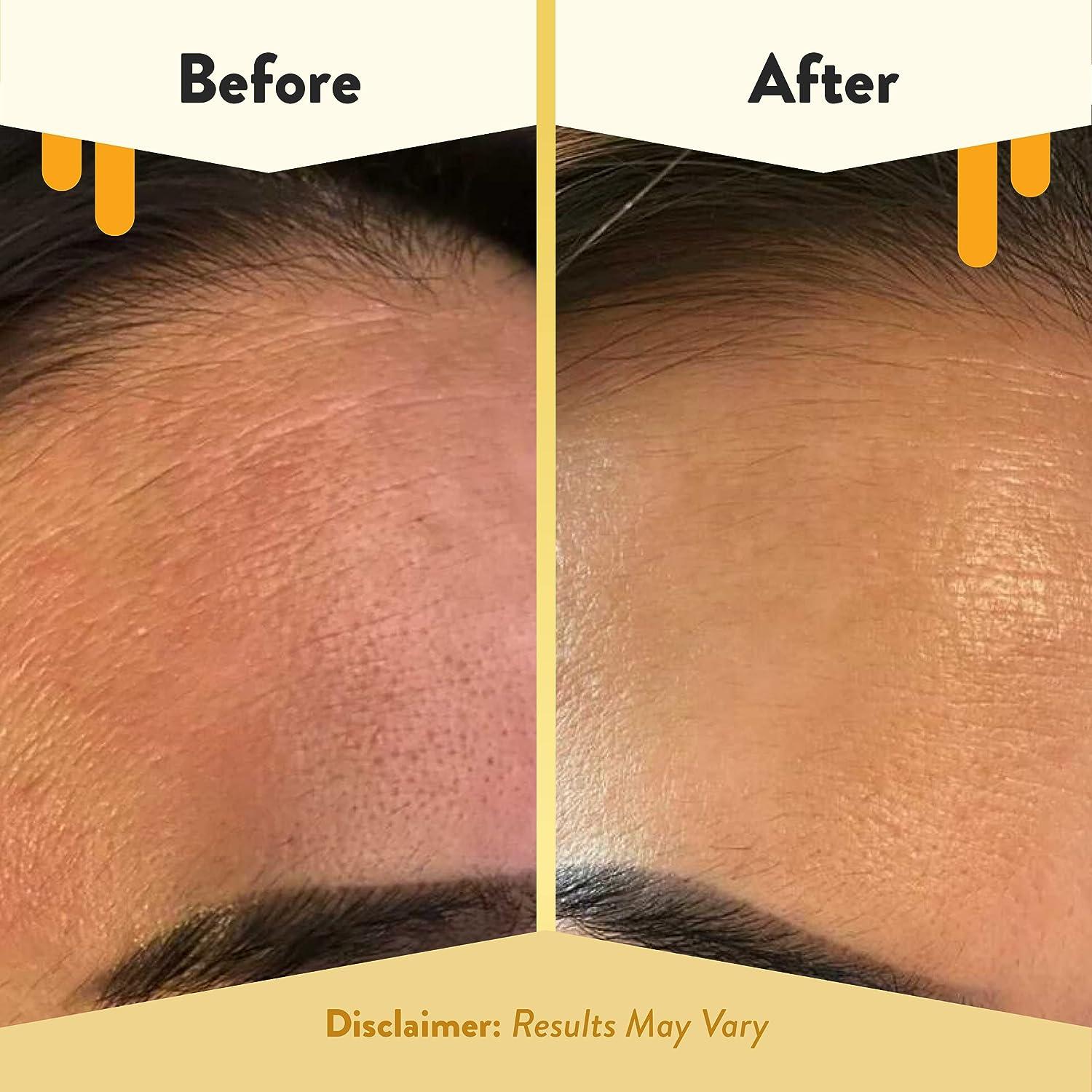 ECZEMA HONEY Concentrated Nighttime Renewal Face Cream Anti Aging