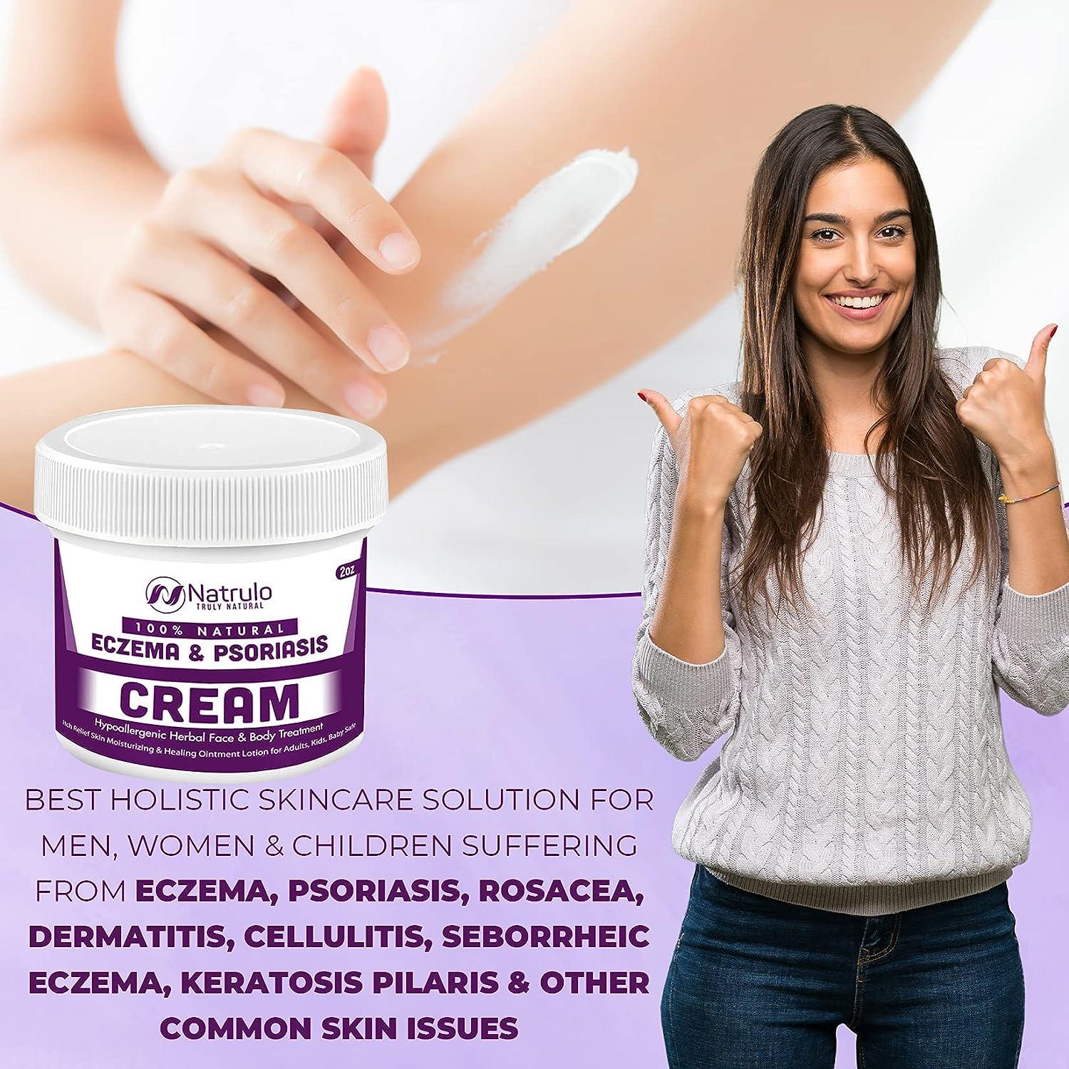 Best eczema cream for babies hotsell south africa