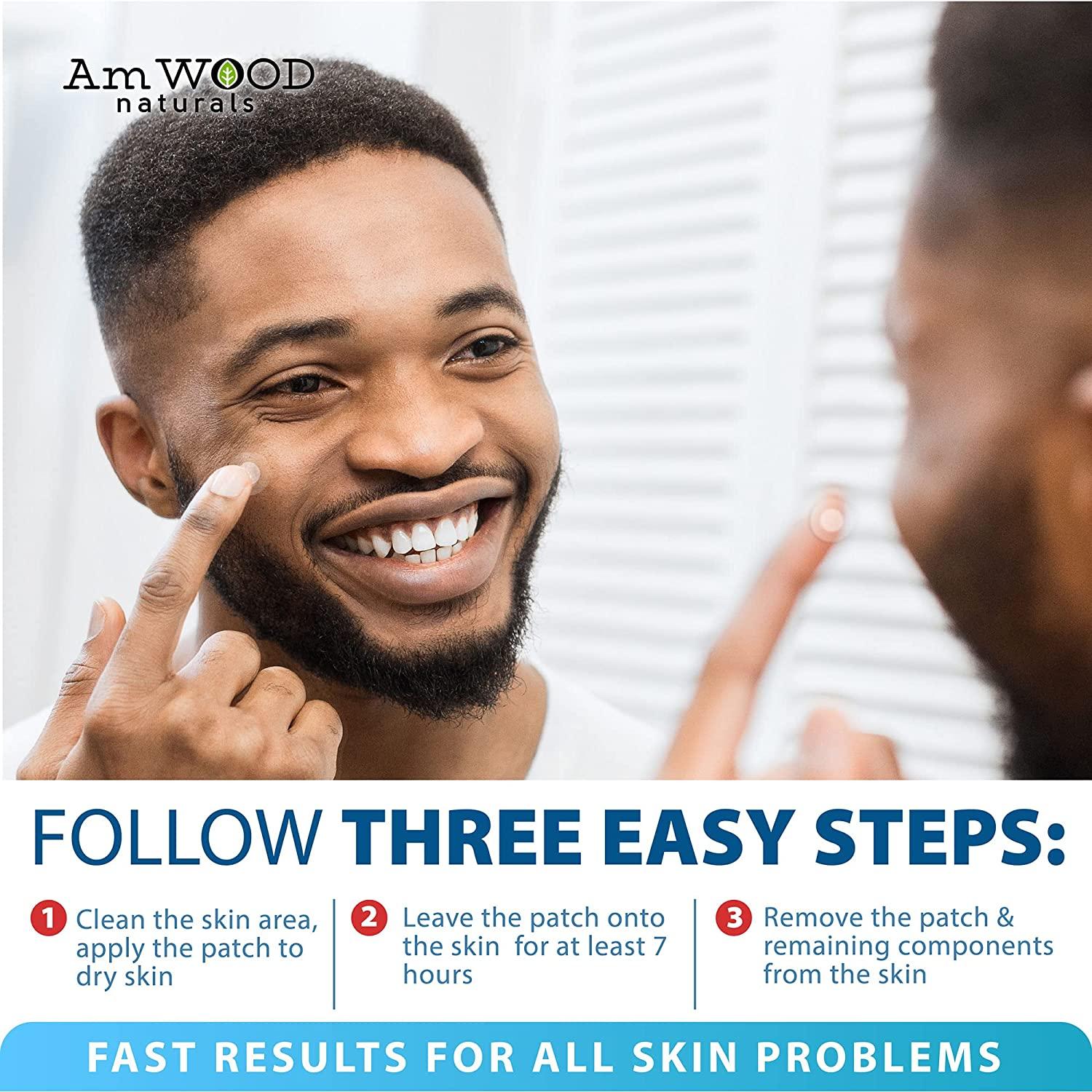 Acne Patches Hydrocolloid Bandages with Salicylic & Hyaluronic Acids