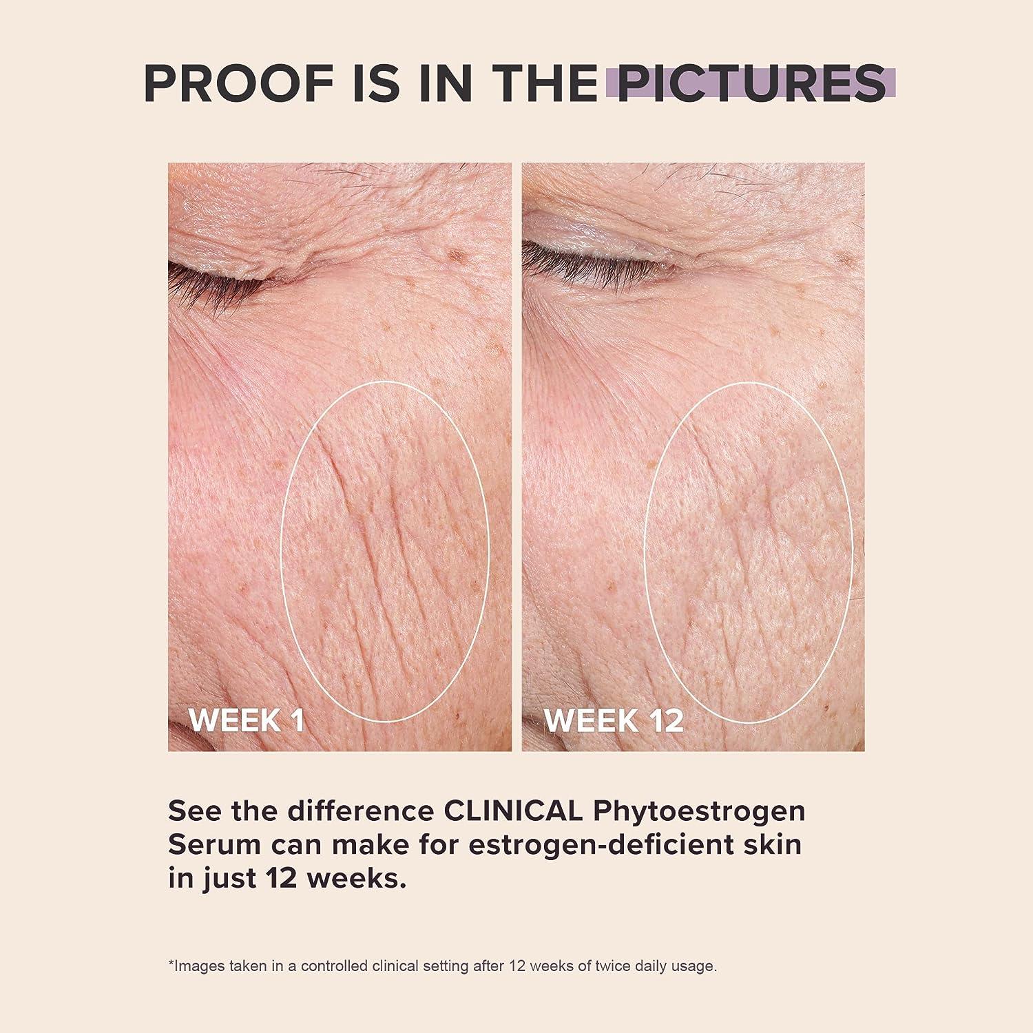 Paula's Choice CLINICAL Phytoestrogen Elasticity Renewal Face Serum 1