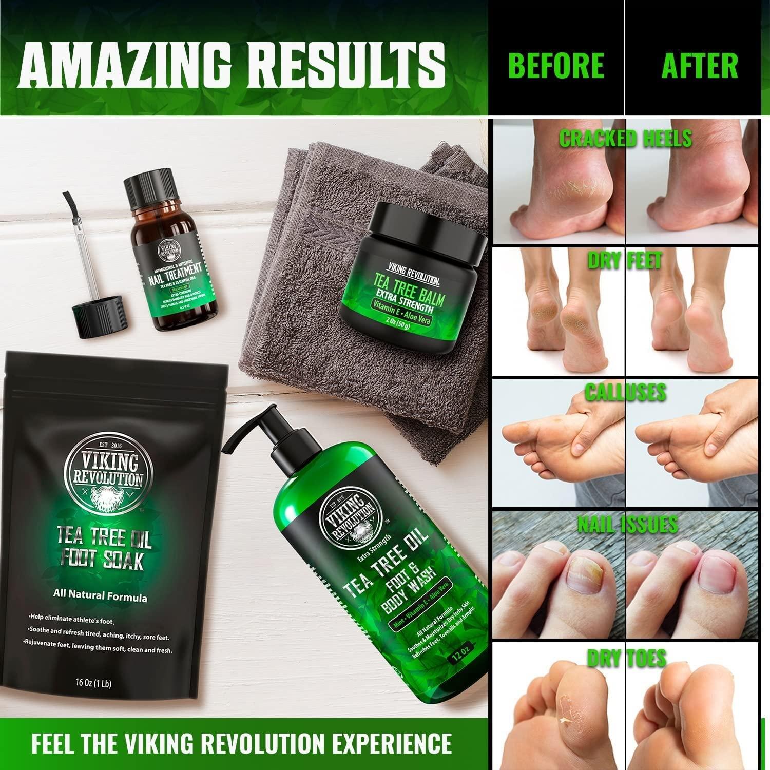 Tea Tree Foot Soak Foot Spa Kit Tea Tree Oil Foot Fungus Soak with