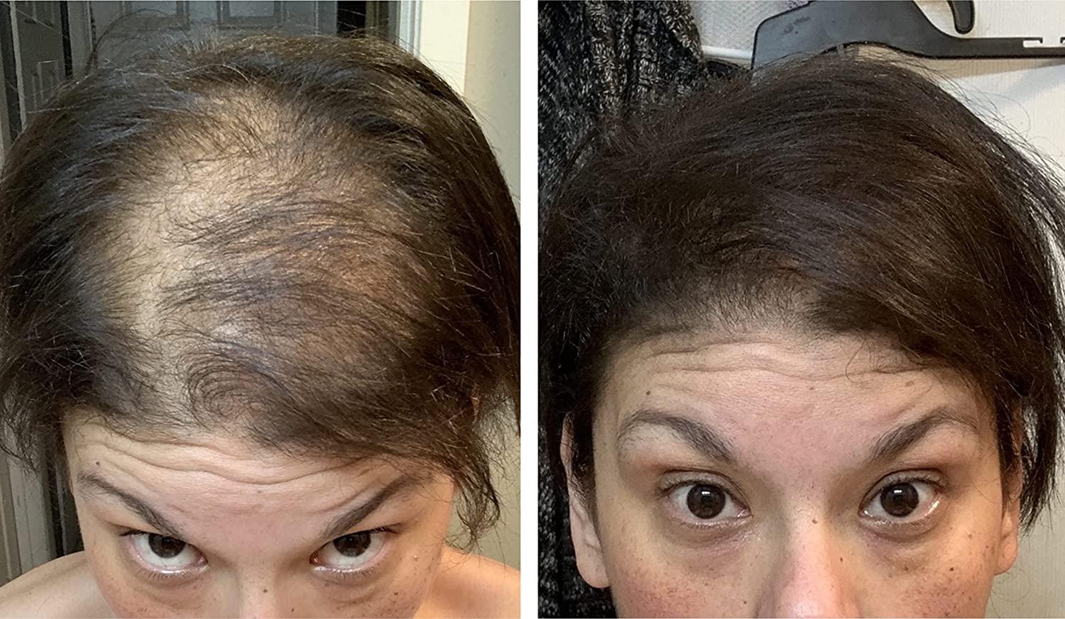 Caboki Hair Loss Concealer. All-Natural Hair Building Fiber. Make Thin Hair  Look 10X Fuller Instantly. Eliminate the Appearance of Bald Spot and  Thinning Hair (30G, 90-Day Supply). Dark Brown
