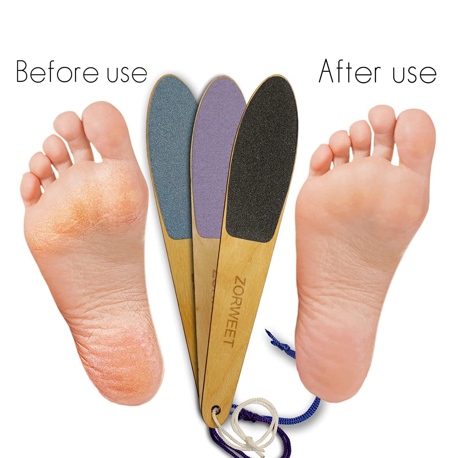 3pcs Coloured Double Sided Foot Files - Pedicure Heel Rasp & Callus ...