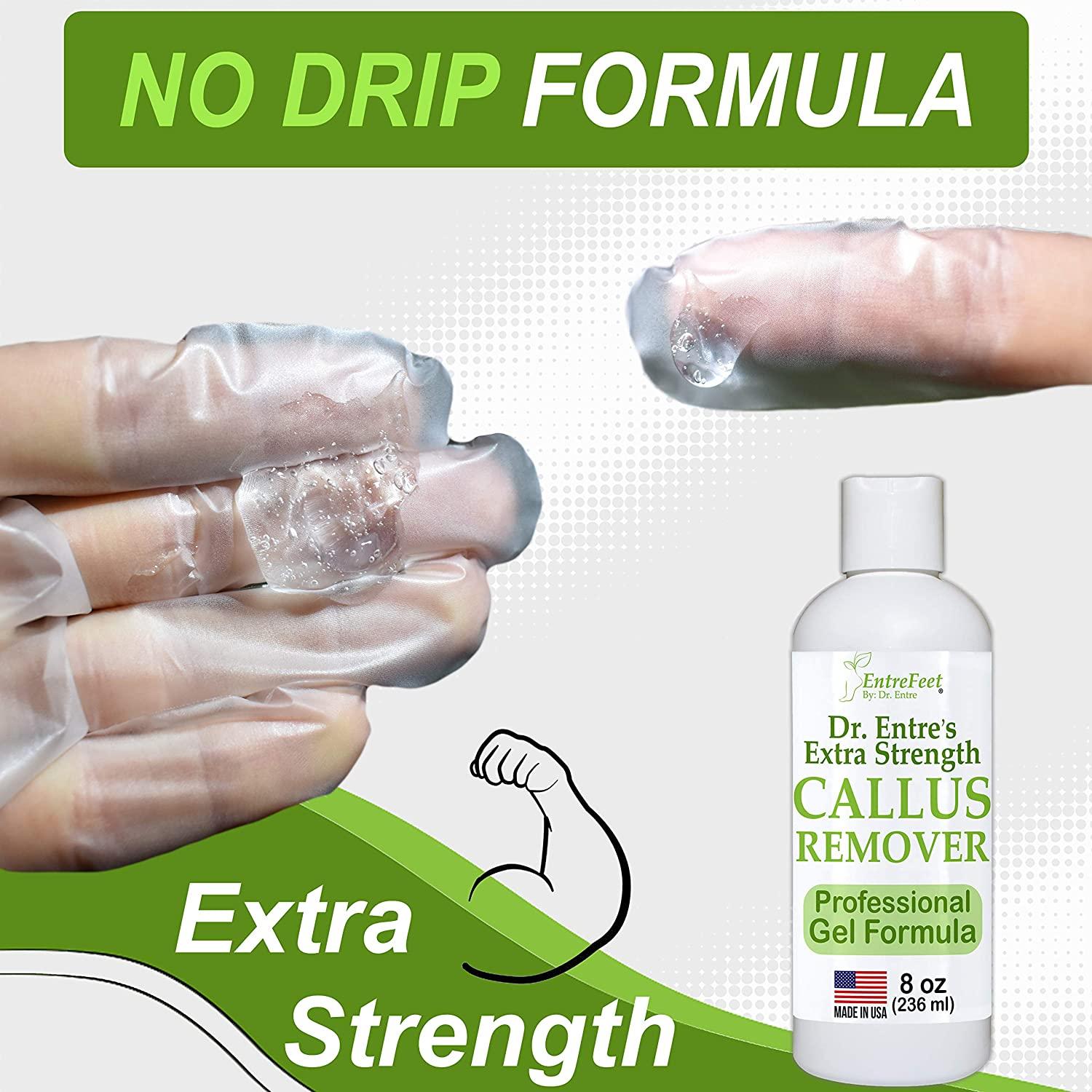 Dr. Entre's Callus Remover Kit for Feet 8oz Callus Remover Gel, Foot