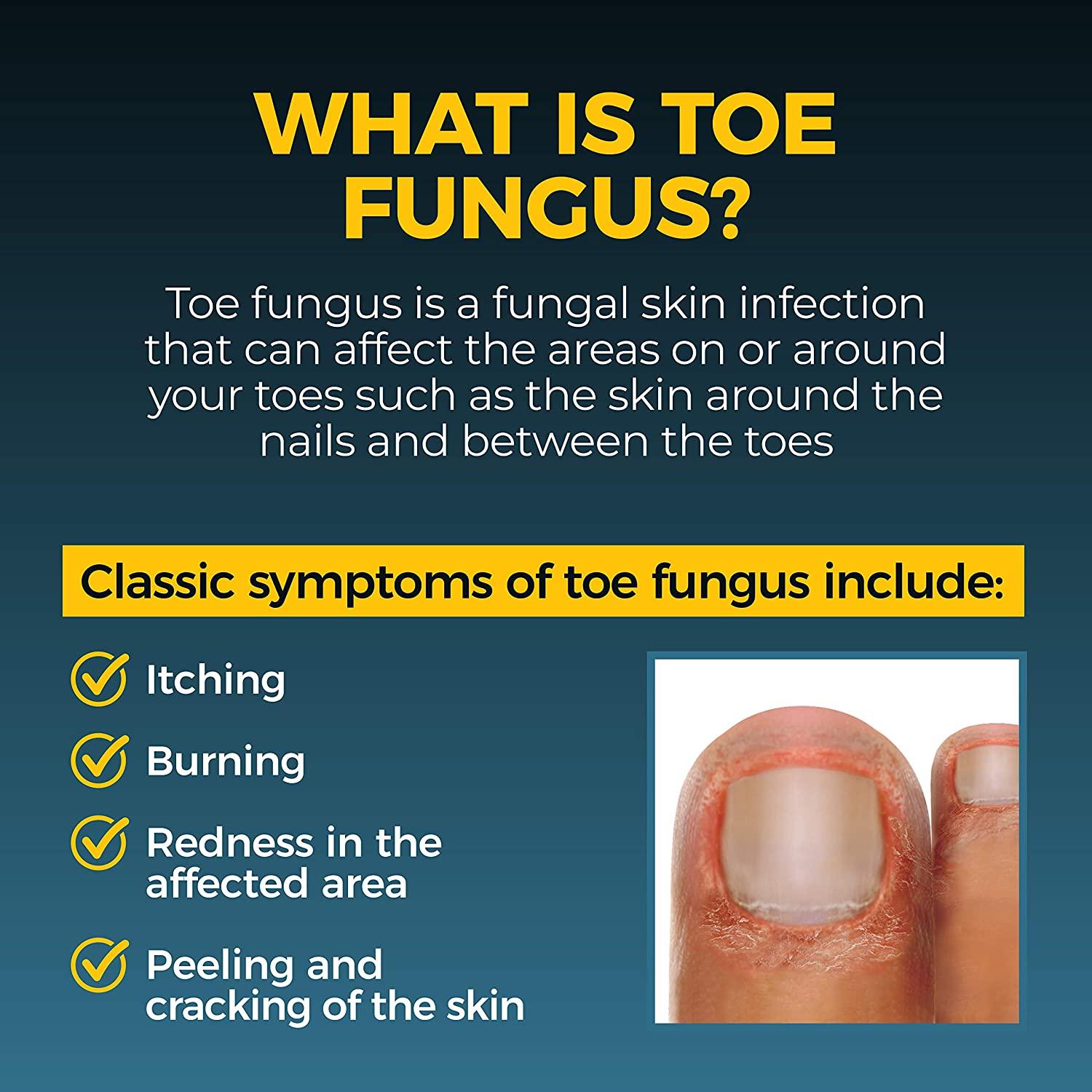 UK Anti Fungal Nail Treatment Liquid Pen Finger Toe Care Nail Fungus  Treatment🥇 | eBay