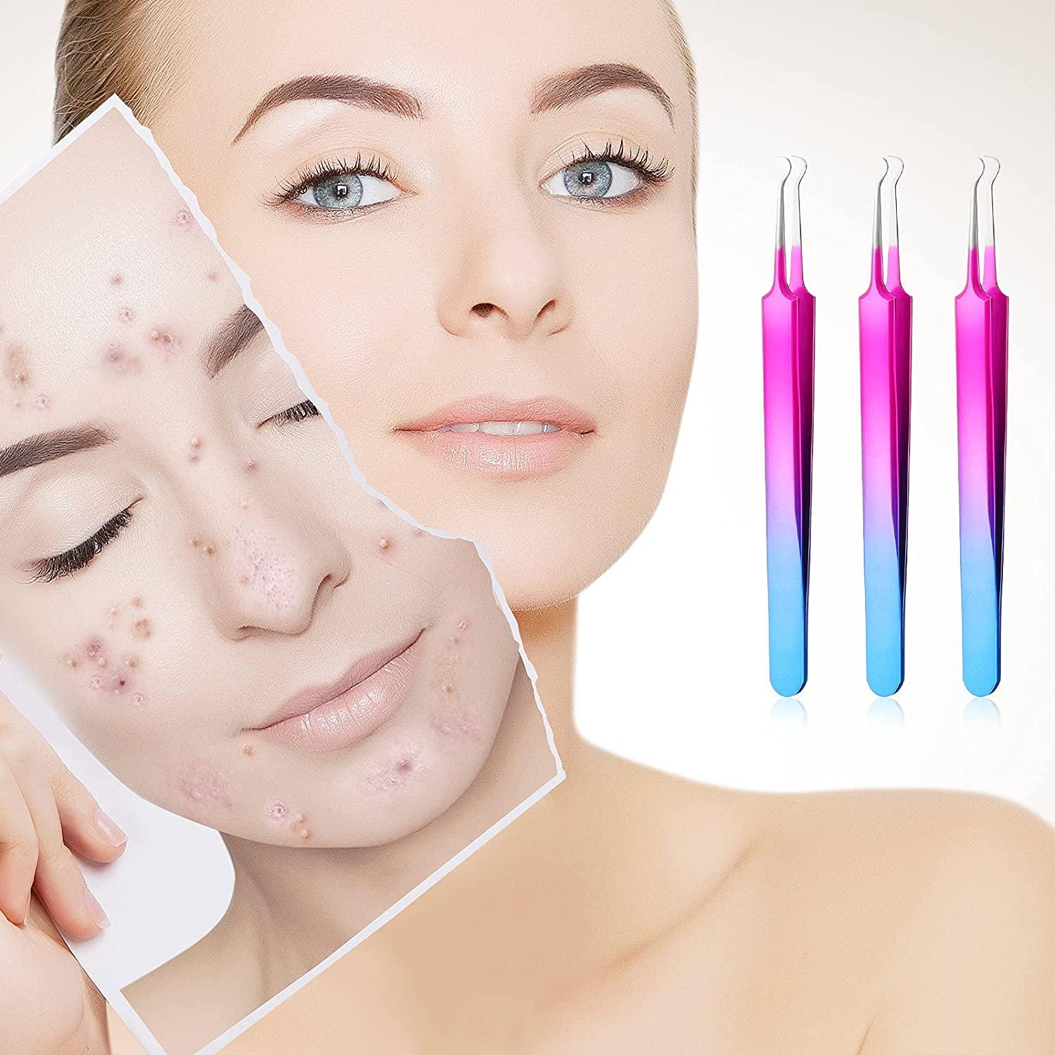 3 Pieces Blackhead Tweezers Blemish Stainless Steel Blemish Extractor