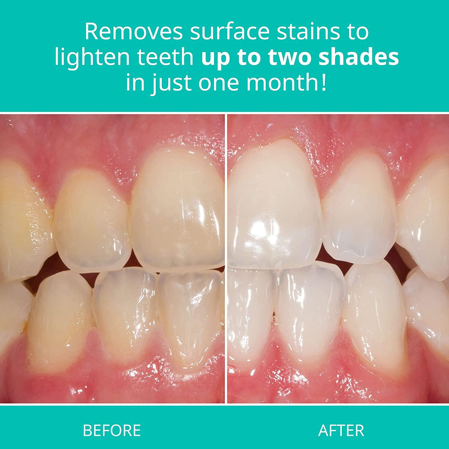 Opalescence Whitening Toothpaste Fluoride Oral Care Cool Mint 4.7 Oz