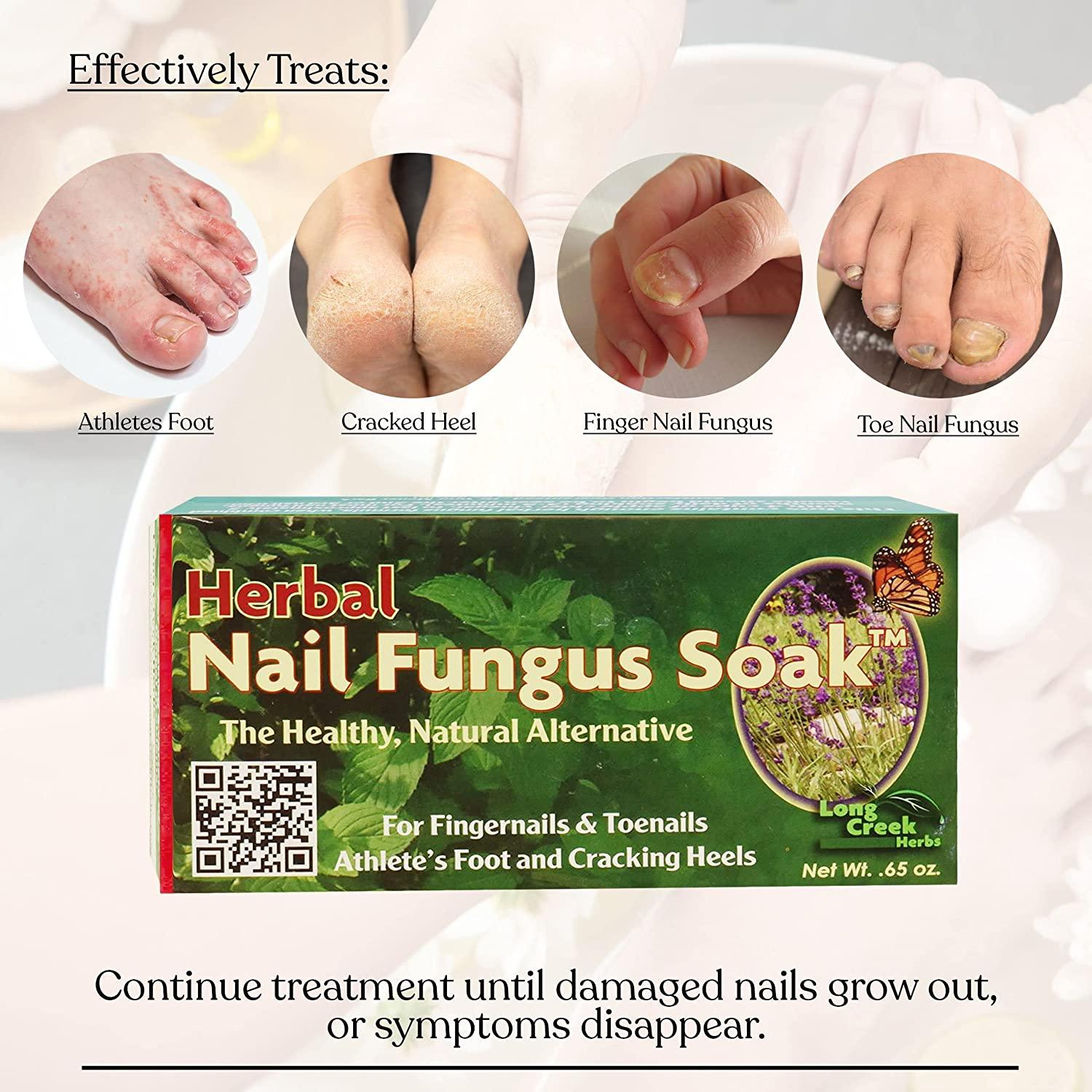 Natural Remedy for Toenail Fungus - Cultured Palate