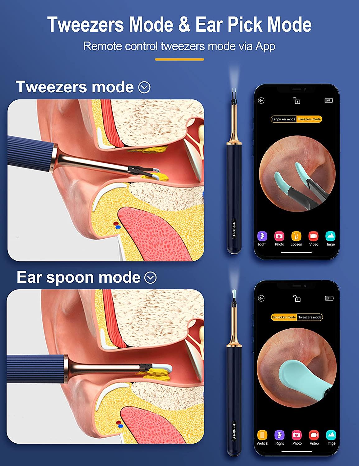 BEBIRD Ear Wax Removal Tool with LED Light and 10.0 MP Camera Blue