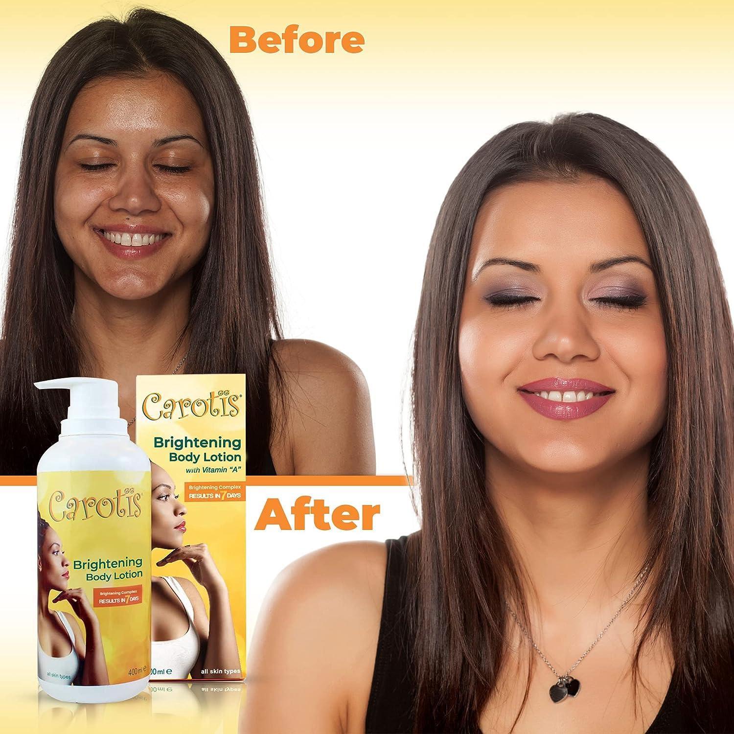 Carotis Skin Brightening Lotion 13.5 Fl oz / 400ml For Body Knees