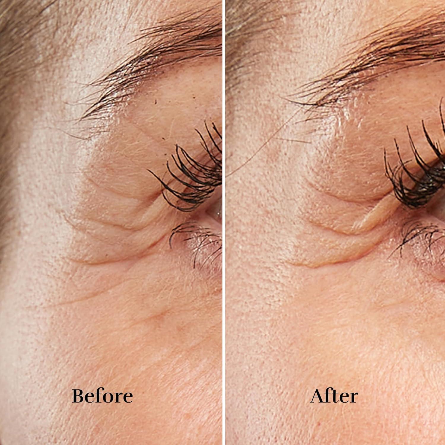 Silk'n FaceTite Mini Wrinkle Reduction & Skin Tightening Cordless