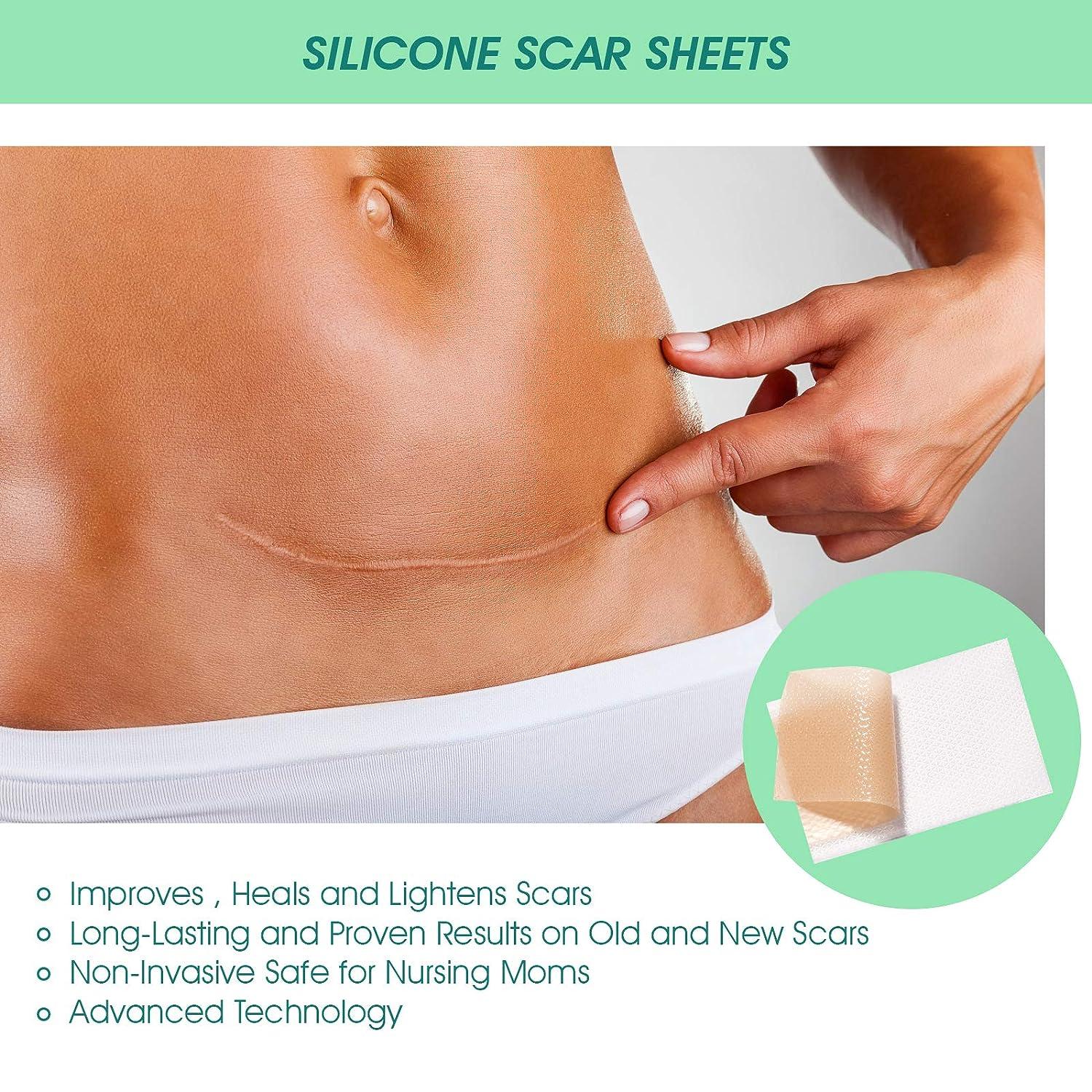 Silicone Strips Scar Removal Sheets Tummy Tuck Breast Reduction Scars