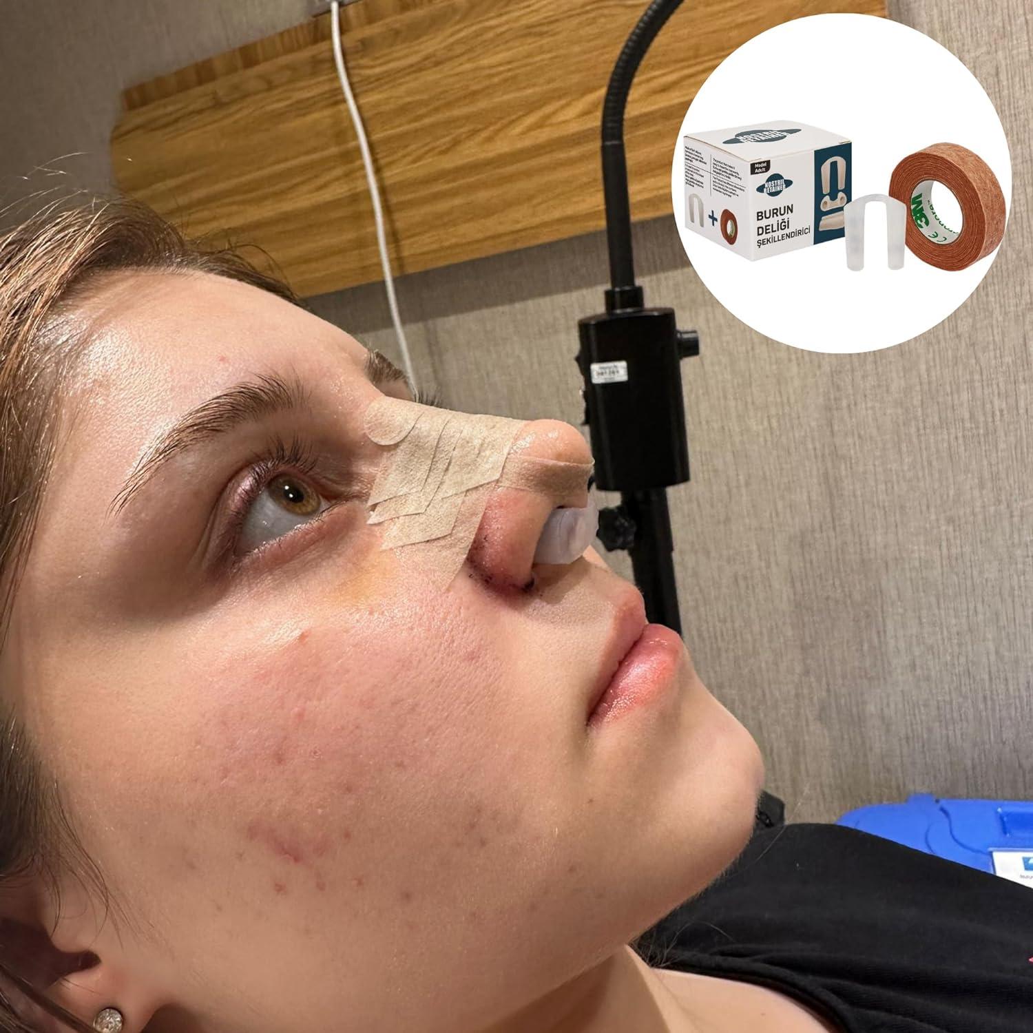 Nostril Retainer Rhinoplasty Nostril Shaping After Nose Surgery, neusvormapparaat van 100% medische siliconen, neuspad voor Surgery, Nostril Support