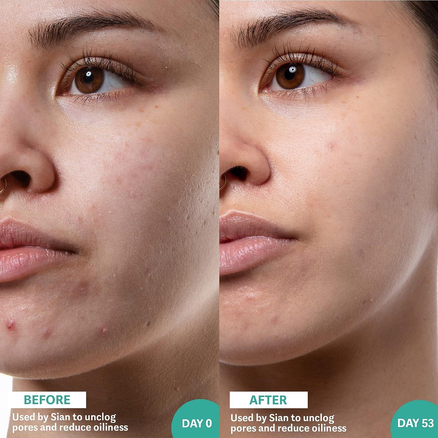 Selfless by Hyram Salicylic Acid & Sea Kelp Pore Clearing and Oil