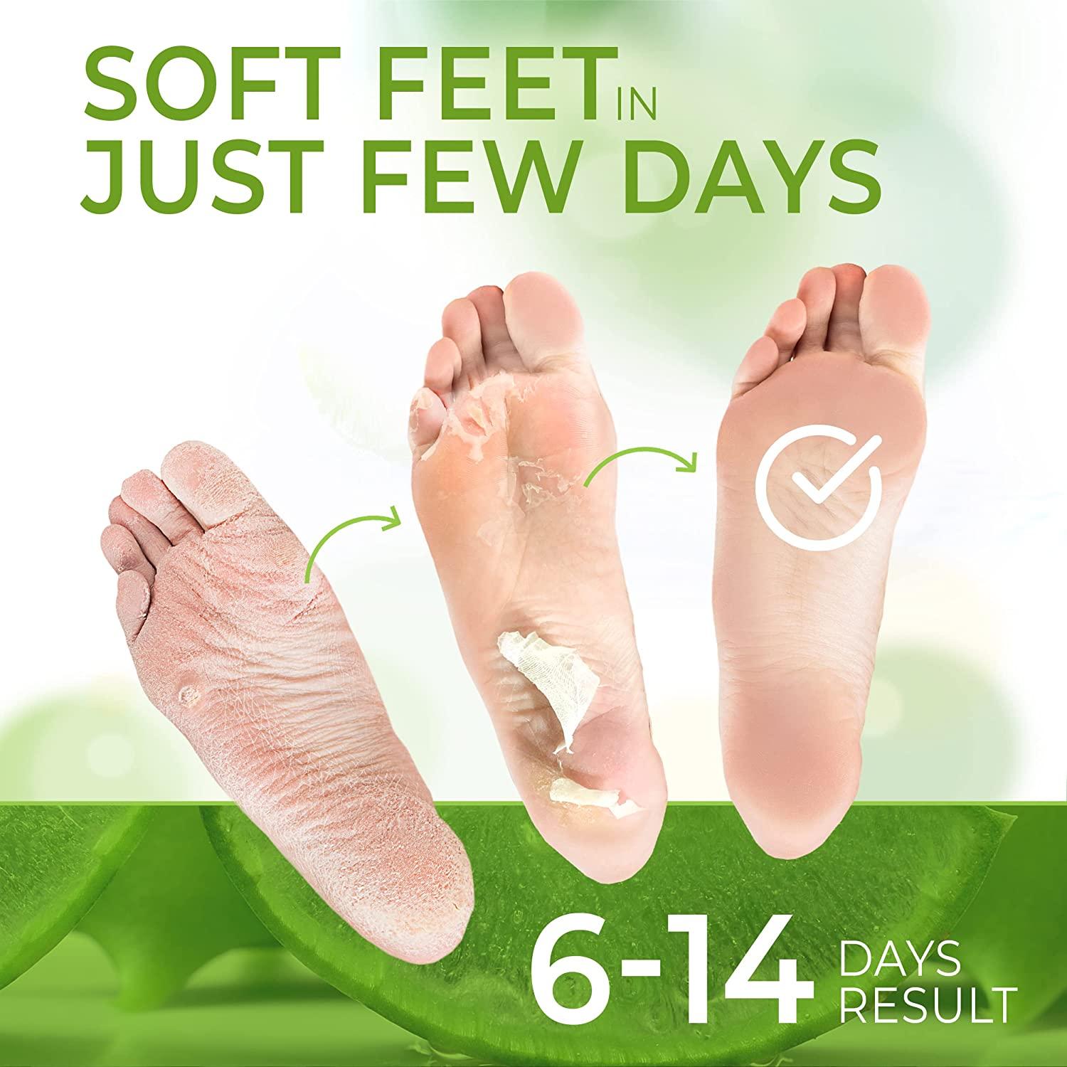 Foot Peel Mask (3 Pairs), Foot Mask with Aloe Vera, Exfoliating Foot