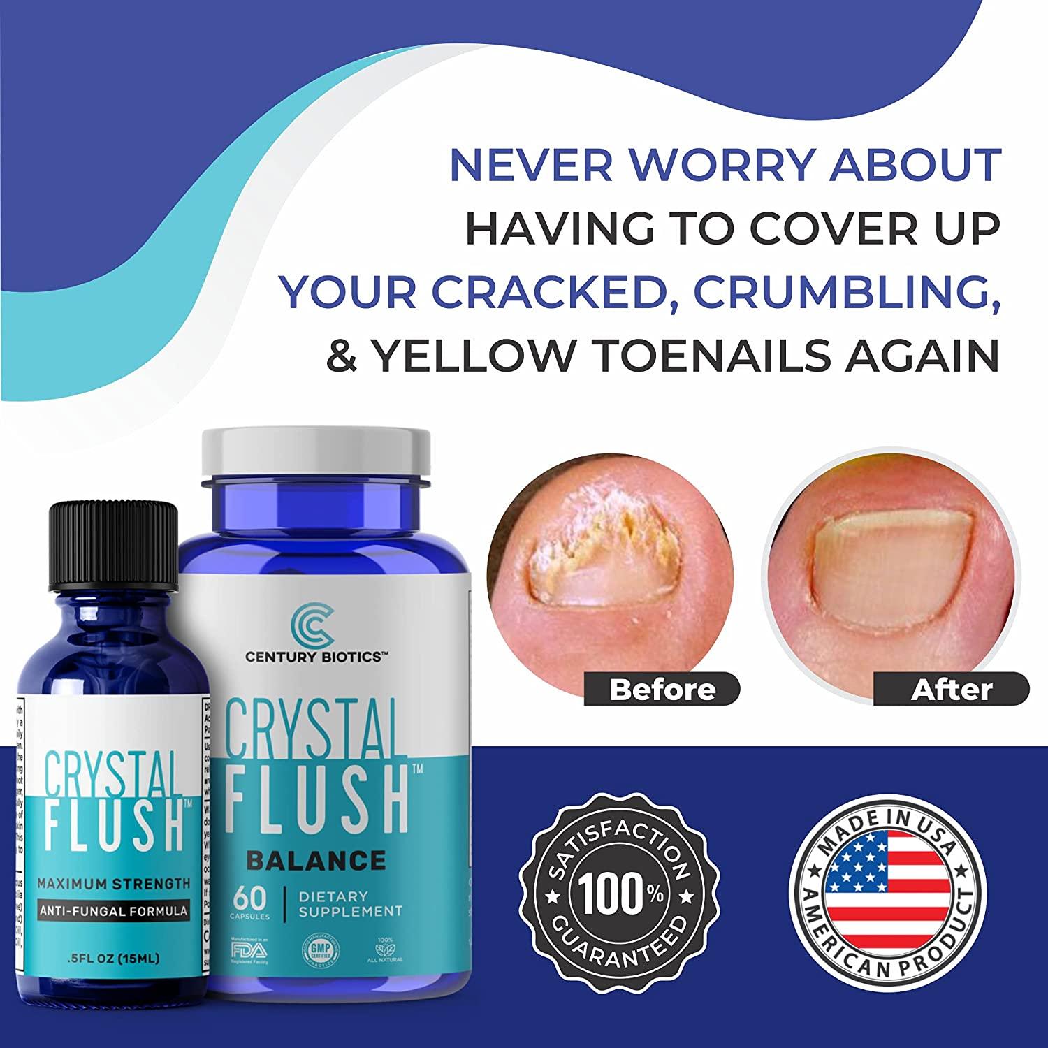 Does Crystal Flush Work On Toenail Fungus Crystal Flush 2 Step Fungus Fighting System - Tolnaftate 1% Anti-Fungal