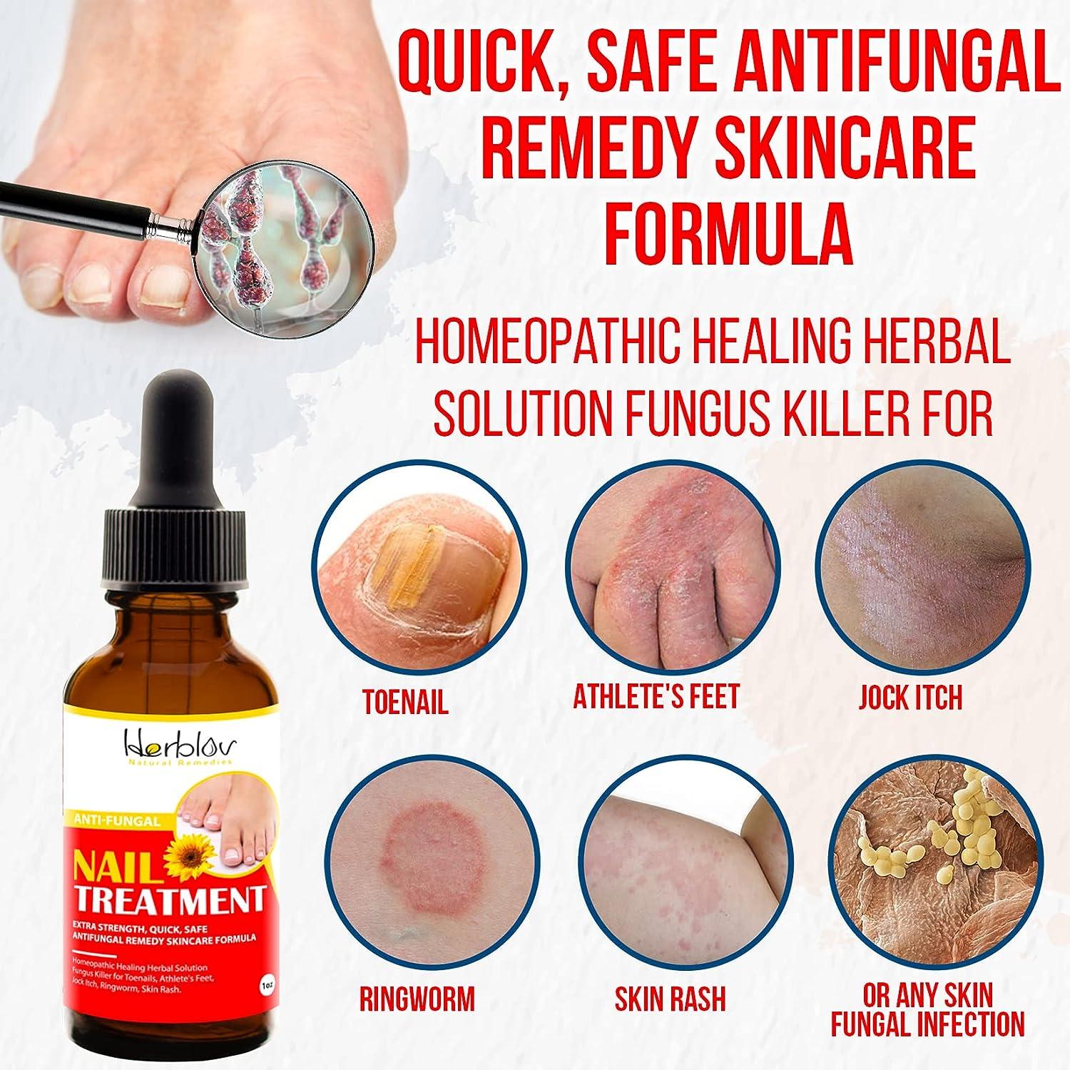 Nail & Toenail Repair Treatment Natural Extra Strength Nail Drops