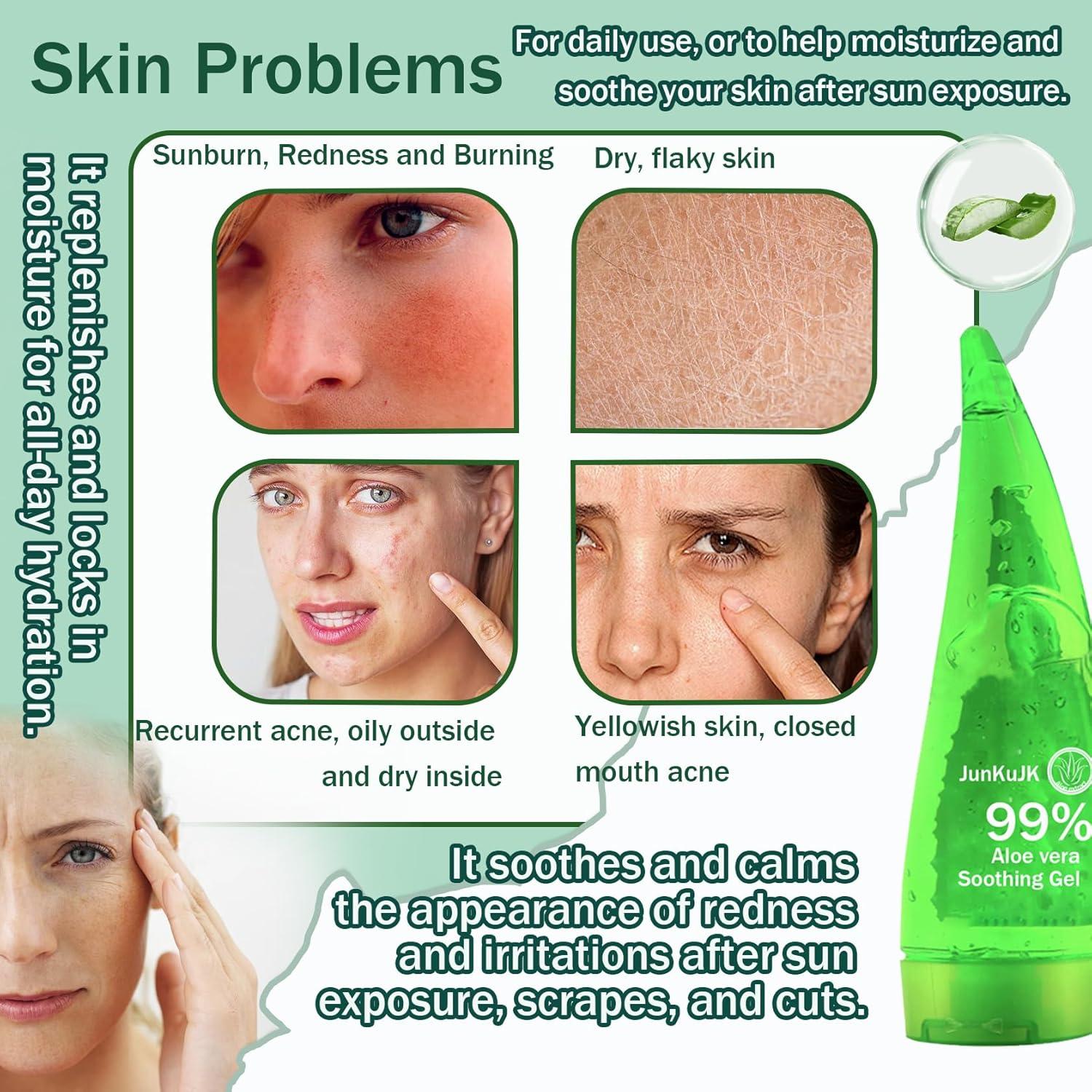 99% Purity Aloe Vera Gel 260ml | Hydrating & Non-Sticky Moisturizer for  Face & Skin - International Shipping Available