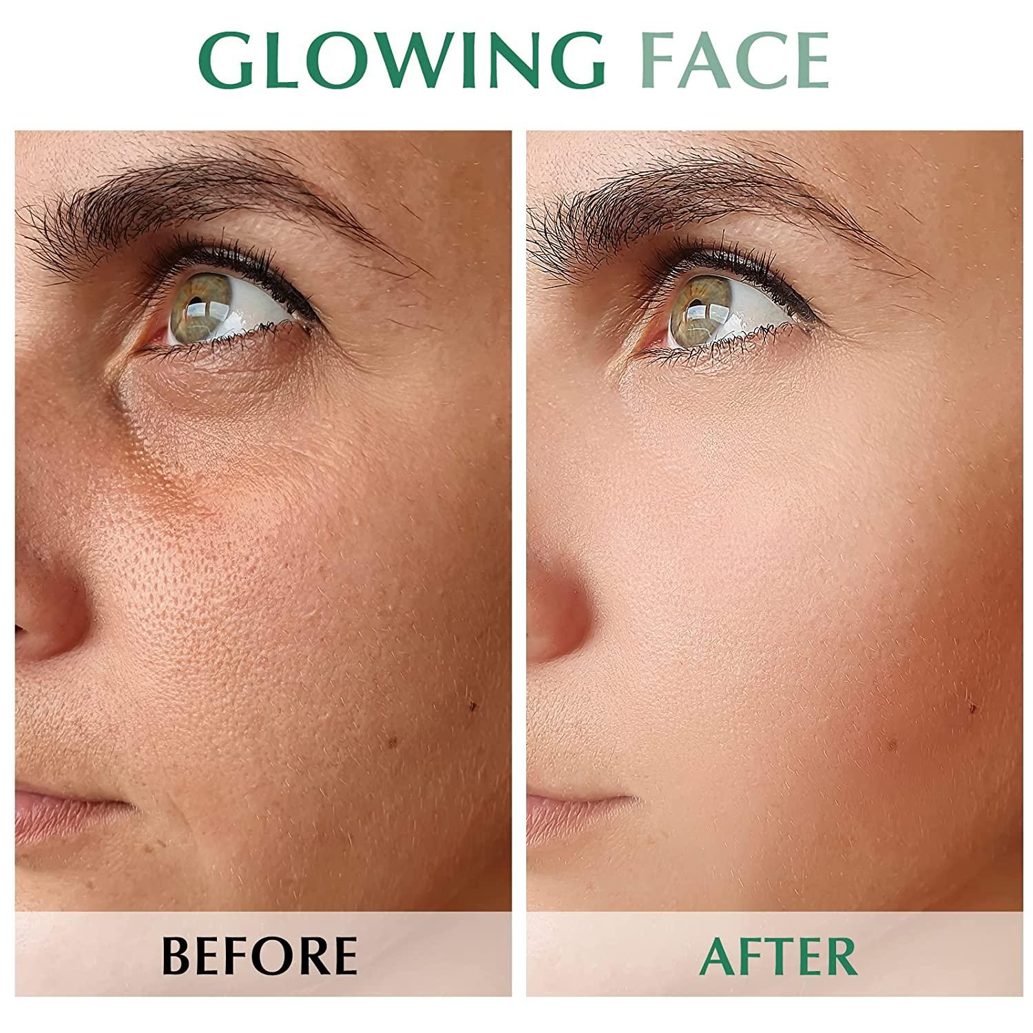 Derma Roller Skin Dermaroller Microneedle Skin Rollers Micro Needle