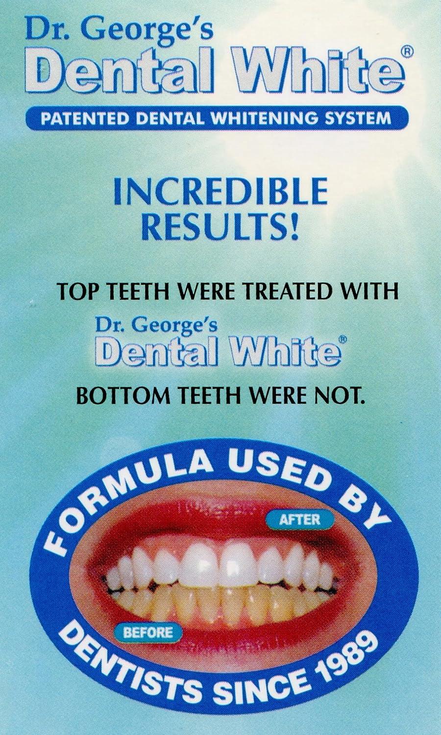Dr. Dental Whitening Gel Professional Instructions Included