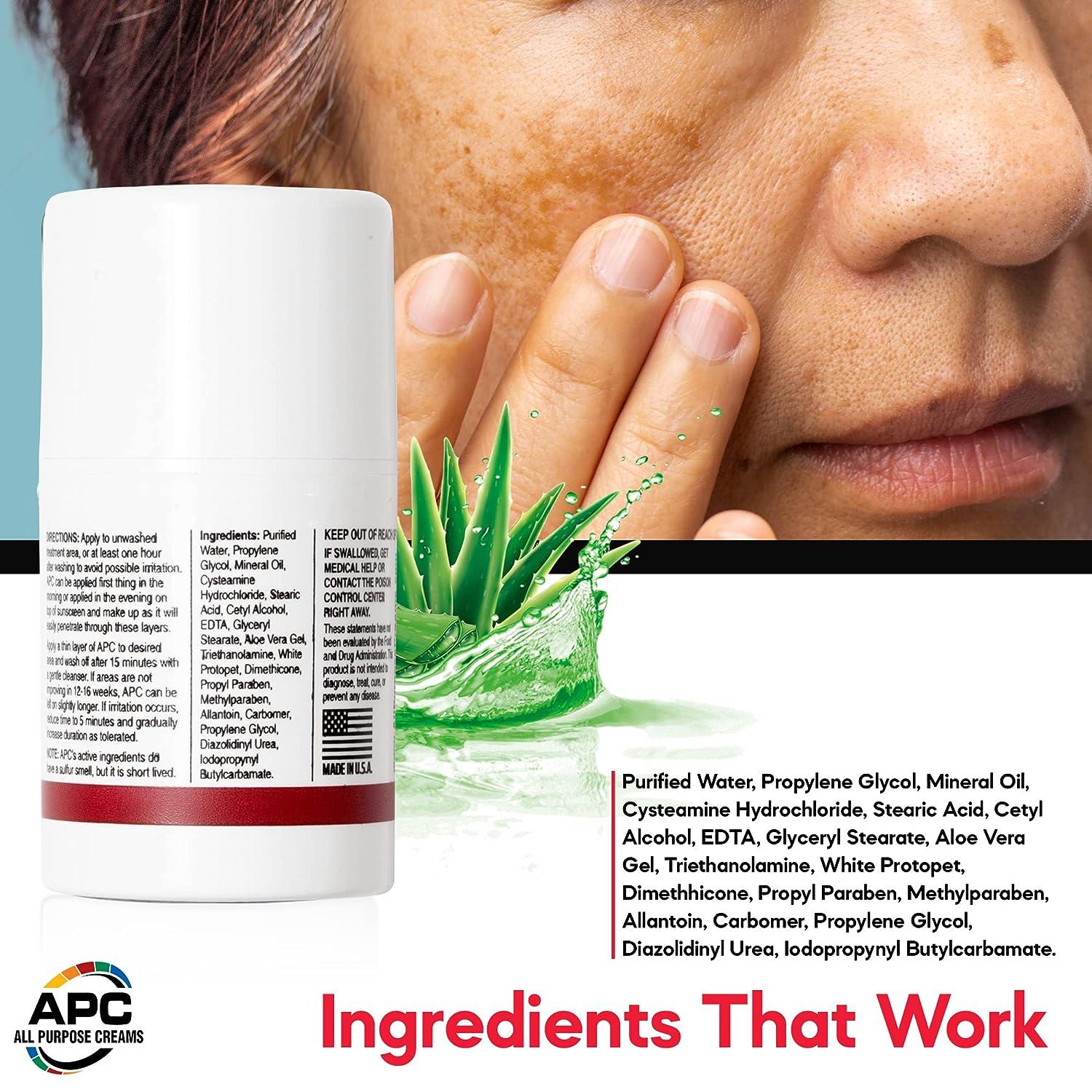 5 Cysteamine Cream 50ml Spot Correction Cream for Melasma Uneven