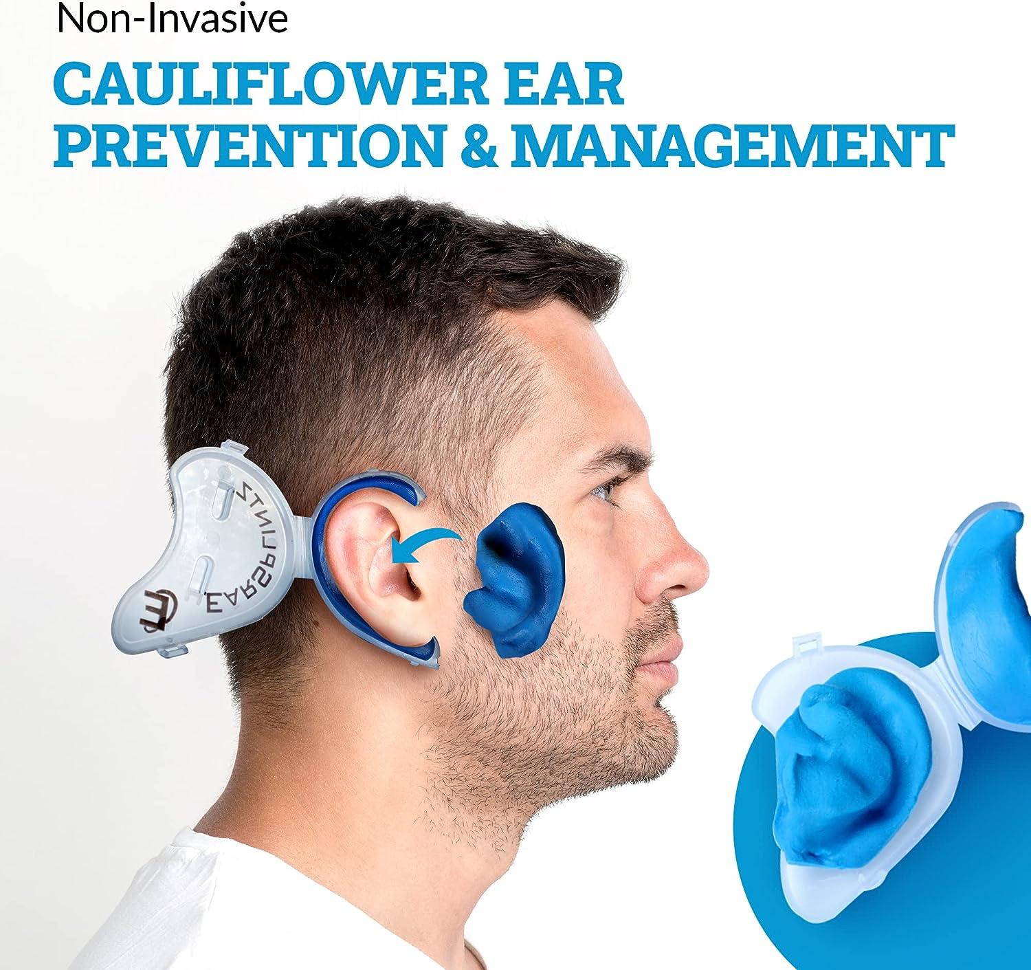 Cauliflower Ear Remedy Superior Alternative to for Ear Therapy