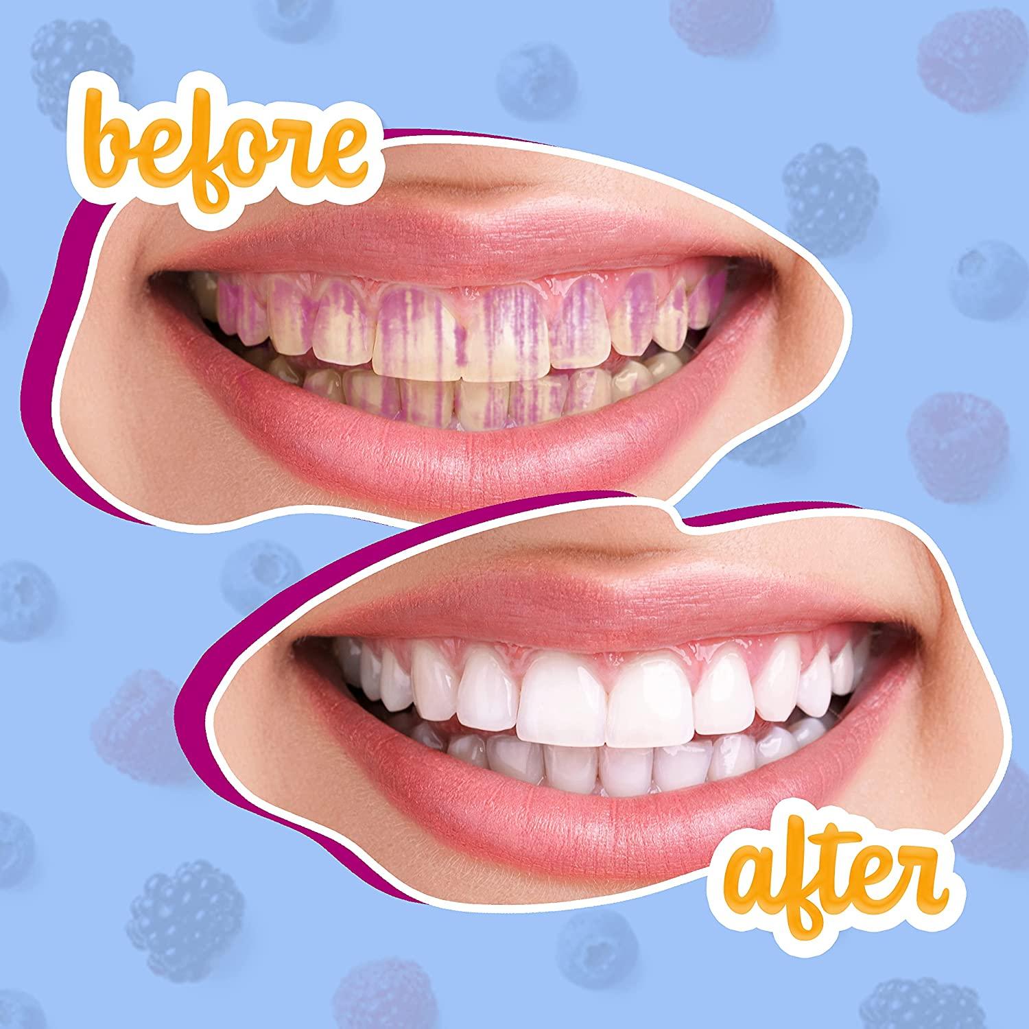 Plaque Disclosing Tablets, Dental Disclosing Tablets, A Teeth Coloring