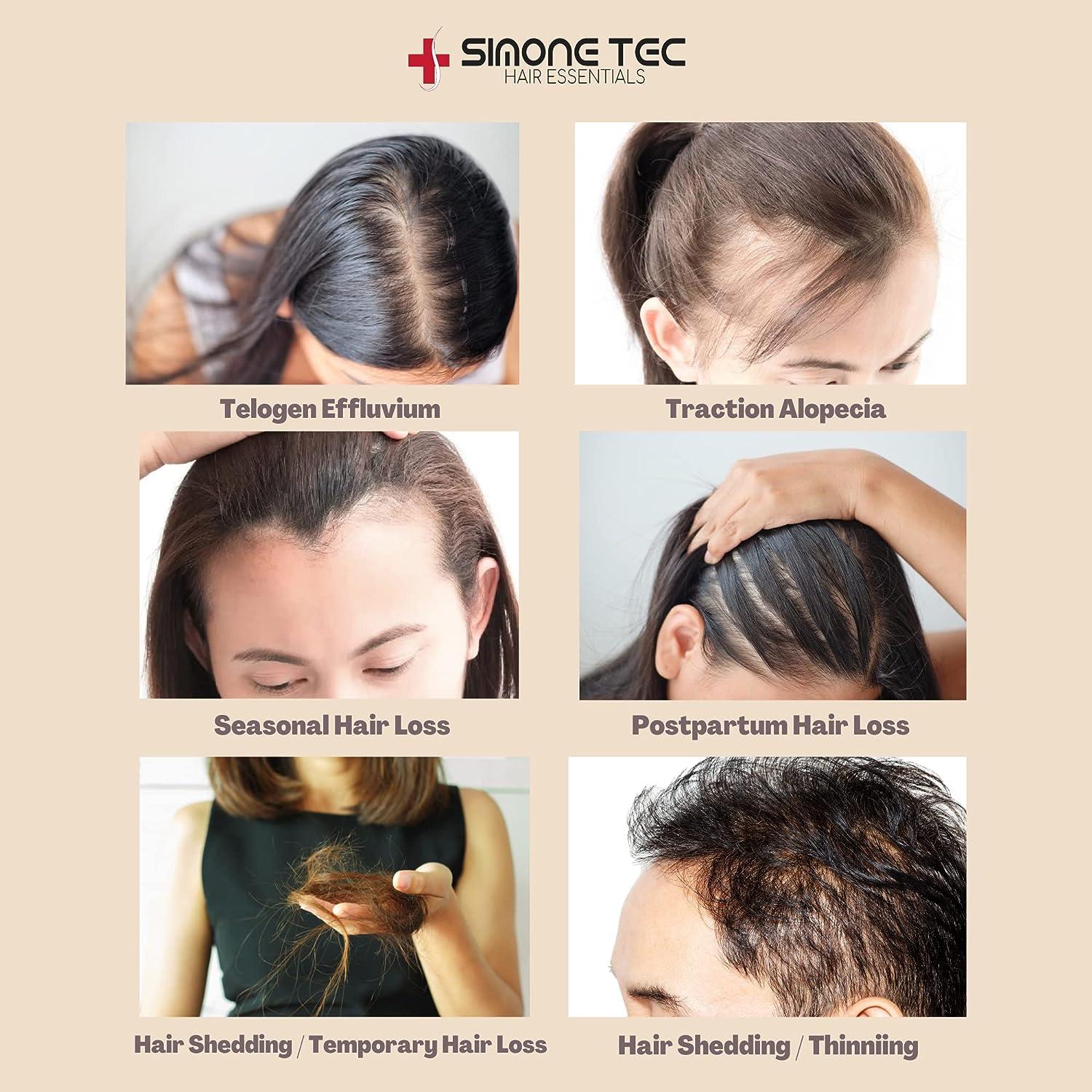 Simone Tec Hair Essentials DNAPOLLEN Hair Growth Stimulating Treatment