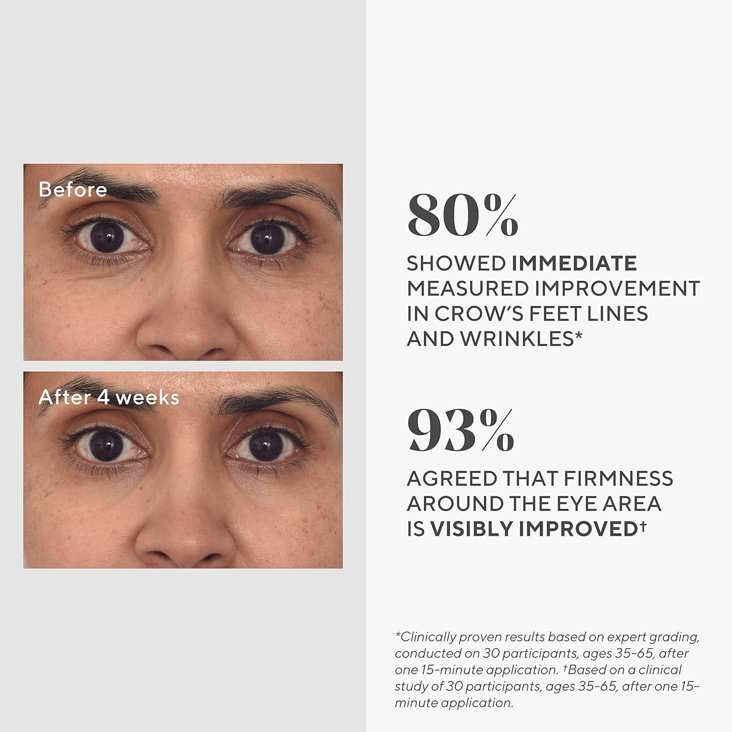 Murad Dr. Zion Retinol Youth Renewal Eye Masks NoSlip Under Eye