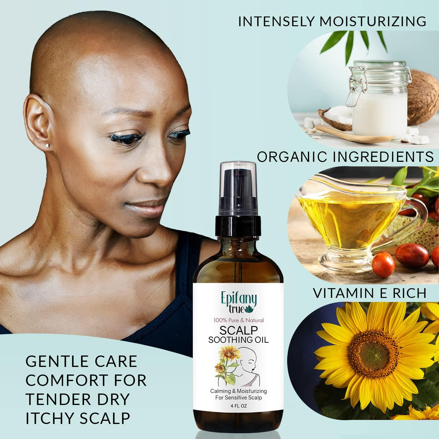 Epifany True Scalp Soothing Oil 4oz for Itchy Dry Sensitive Scalp