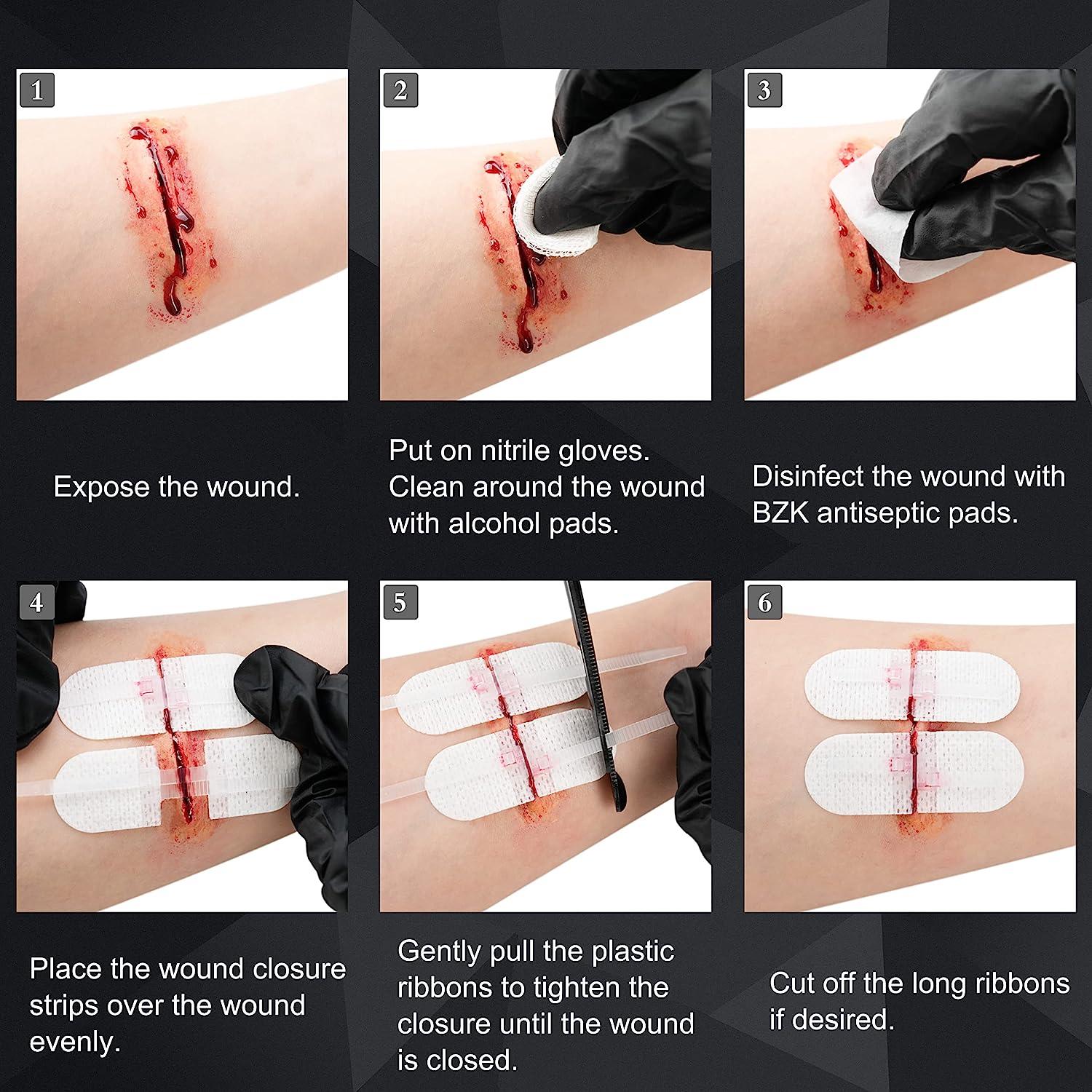 RHINO RESCUE Zip Stitch 6pcs | Wound Closure Strips Kit | Adhesive Bandages for Cut Care | Buy Now with Express International Delivery | GoSupps.com RHINO RESCUE Zip Stitch 6pcs | Wound Closure Strips Kit | Adhesive Bandages for Cut Care | Buy Now with Express International Delivery | GoSupps.com