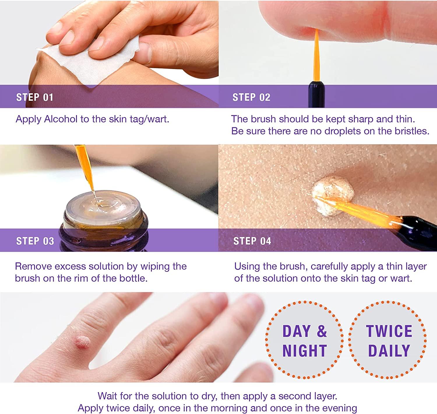 Liquid Skin Tag Remover Patches Extra Strength*2, Liquid Skin Tag