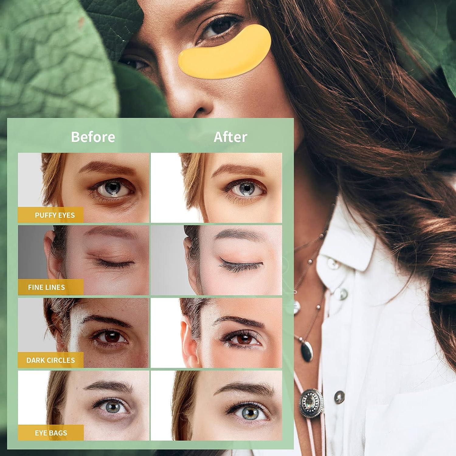 Under Eye Patches for Puffy Eyes Treatment 24 Pairs, 24K Gold Under Eye