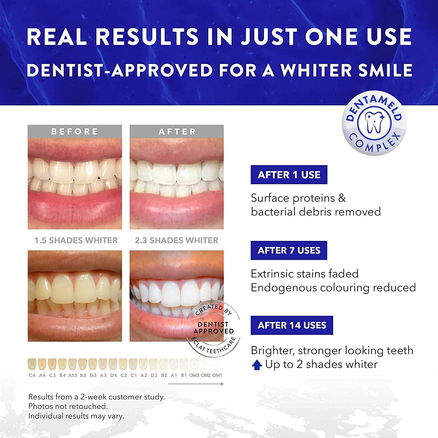 Teeth Whitening Strips 3X Whiter Patented DentaMeld Formulation