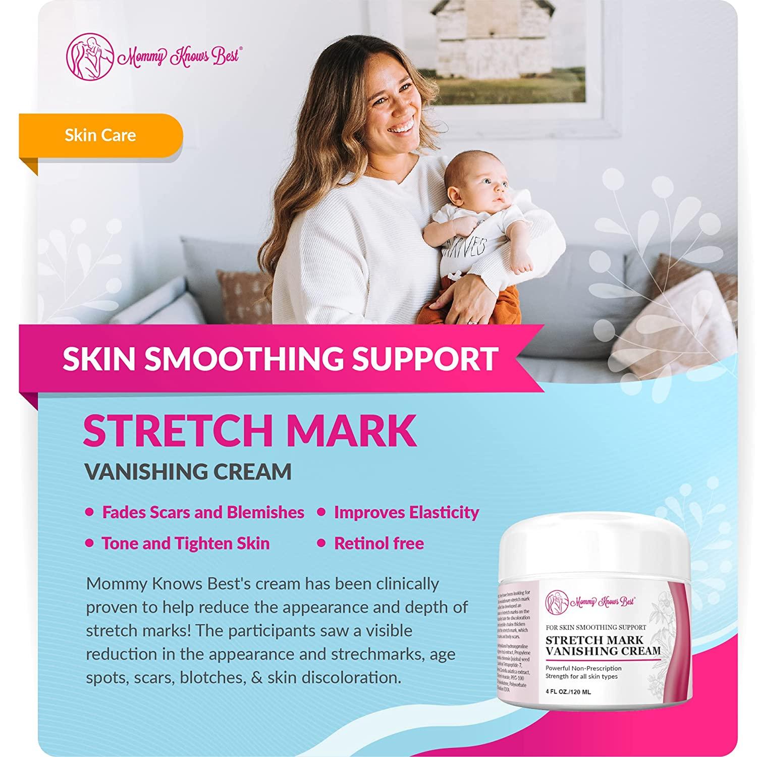Pregnancy Stretch Mark & Scar Removal Cream Shea & Cocoa Butter