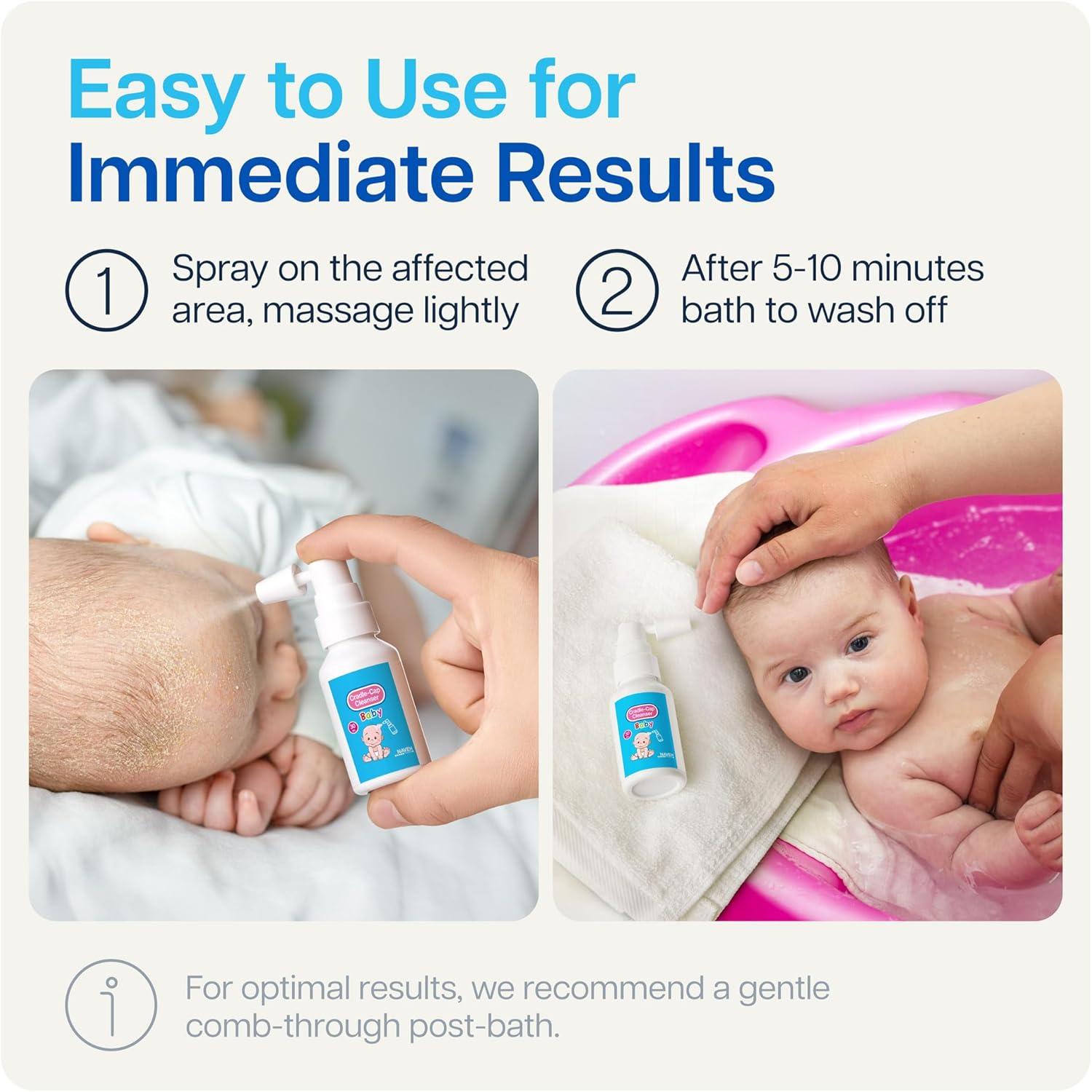 NAVEH PHARMA Cradle Cap Cleanser For Baby Kids 100% Natural