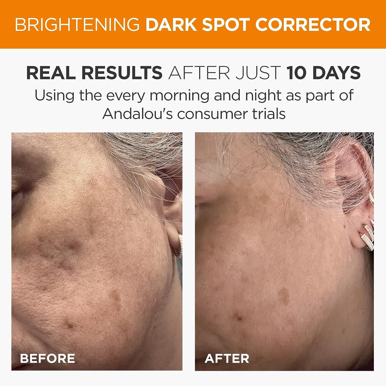 Andalou Naturals Dark Spot Corrector Brightening Face Serum with