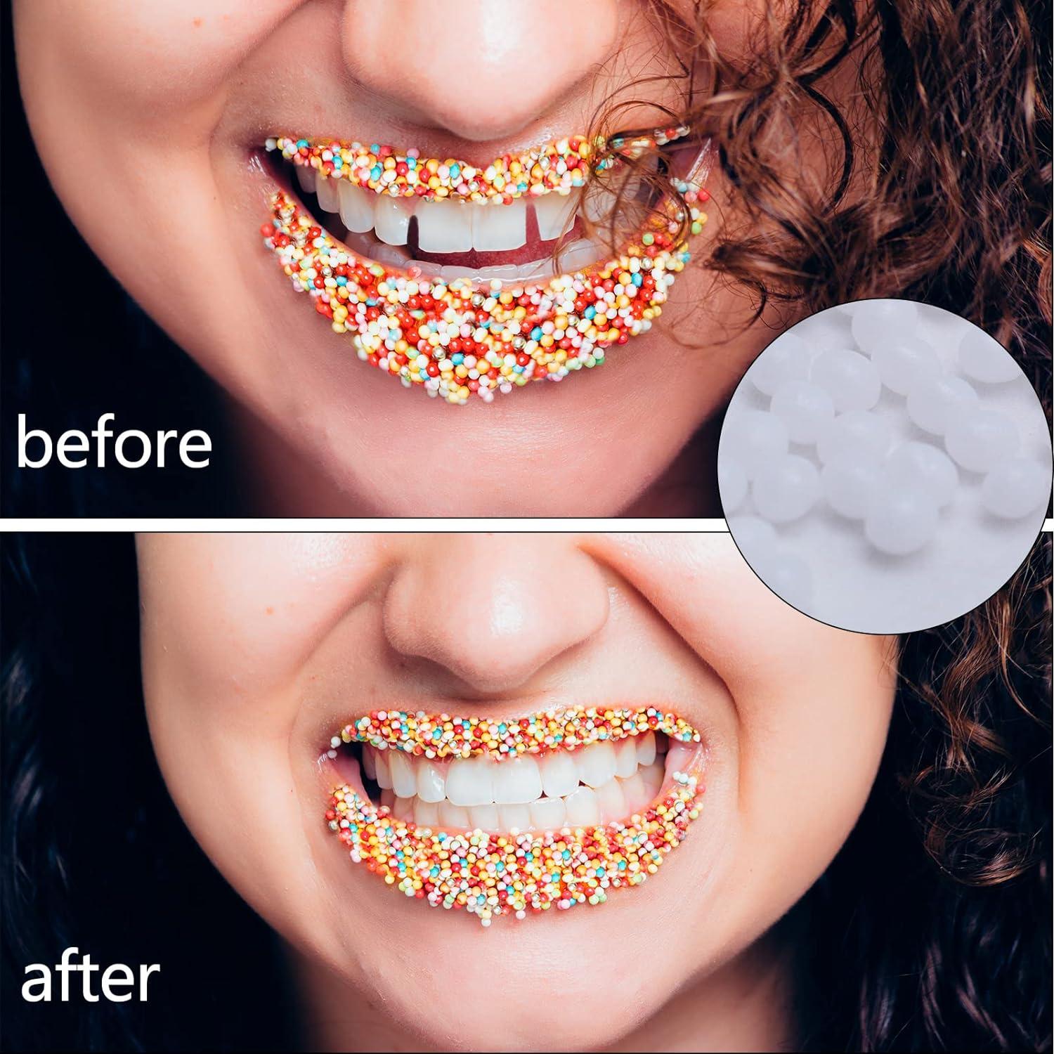 Dental Beads Walgreens - phy1tje