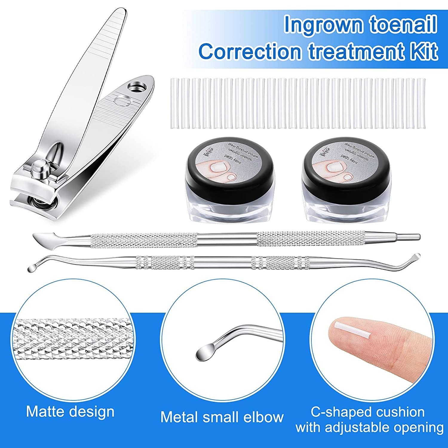 103 Pack Ingrown Toenail Correction Kit 100 Pieces Ingrown Toenail