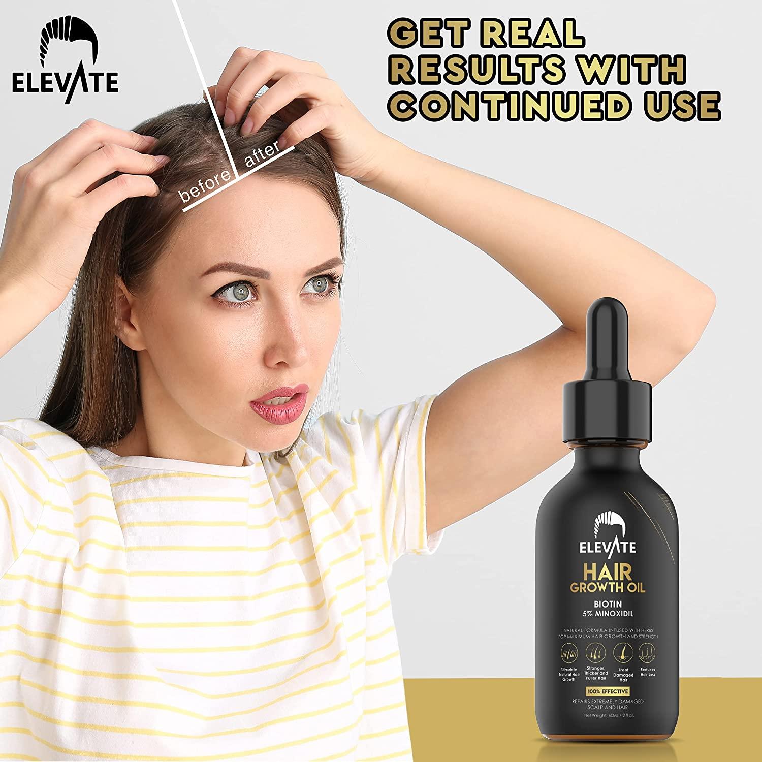 ELEVATE Hair Growth Oil - Biotin Hair Growth Serum & 5% Minoxidil Treatment  for Stronger Thicker Longer Hair Natural Hair Growth Thickening Treatment -  Stop Thinning & Hair Loss for Men &