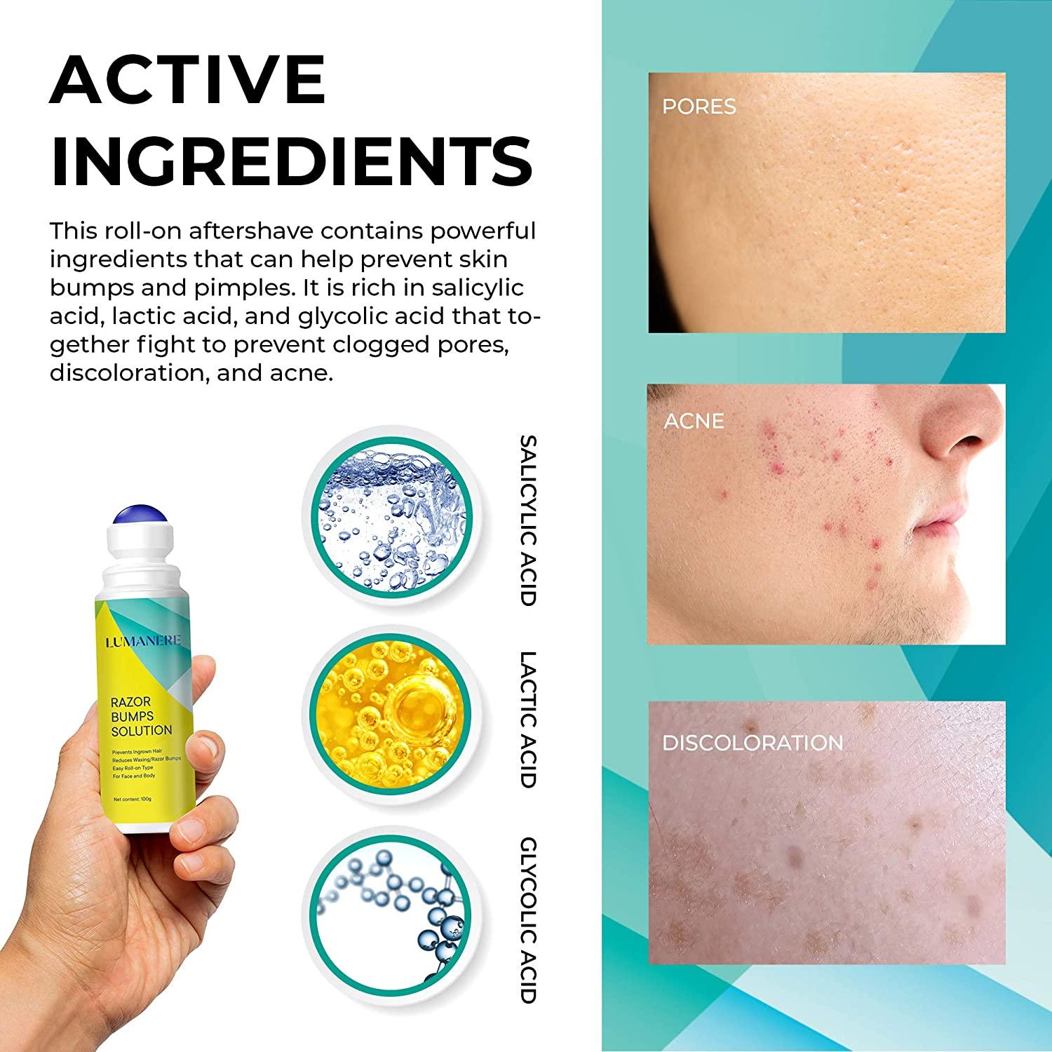 Lumanere razor bump solution clearance