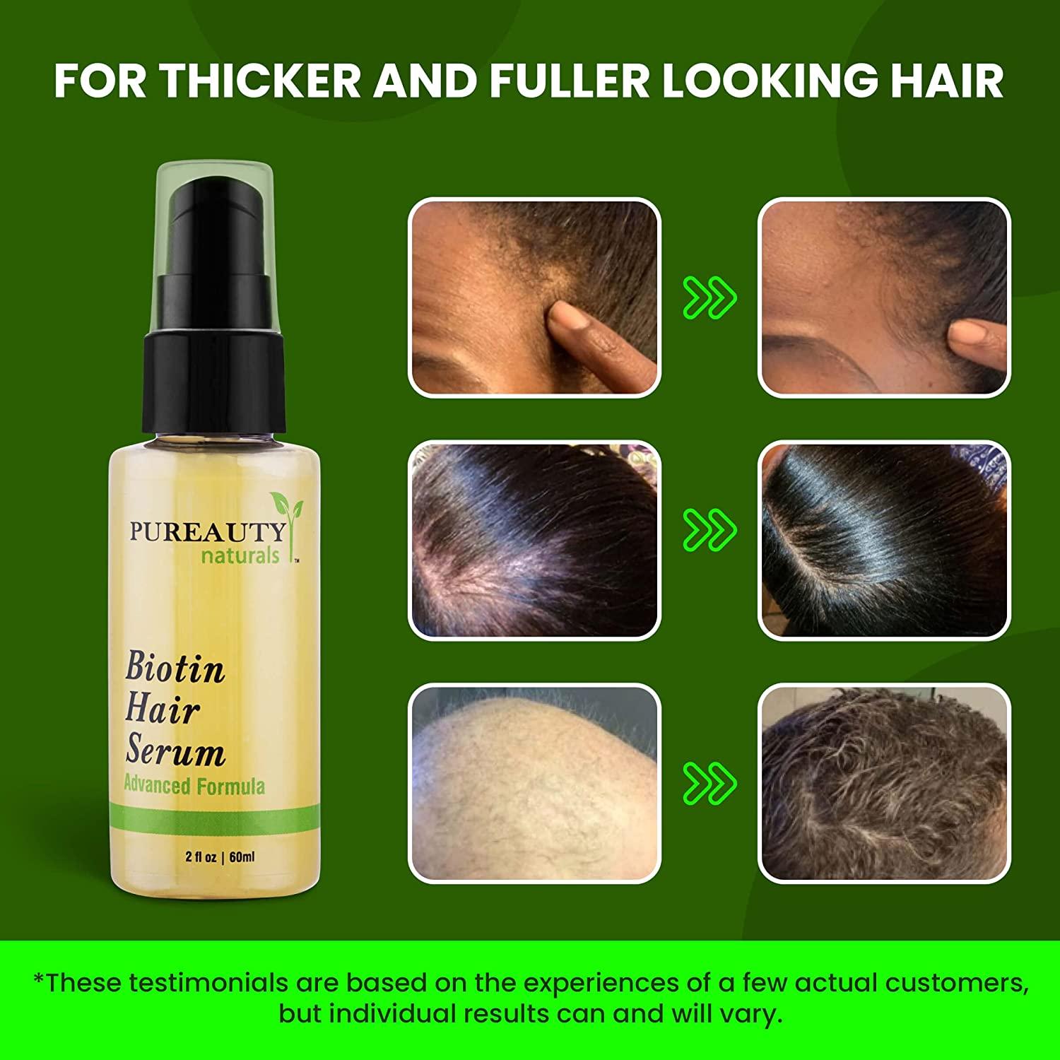 Biotin Hair Growth Serum Biotin serum & Hair growth oil and hair serum Topical hair growth
